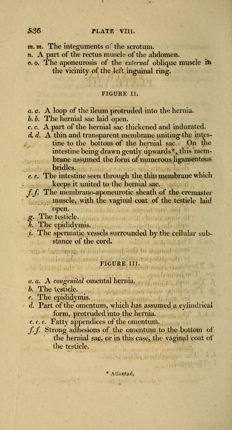 S26 PLATE Vlll. m. m. The integuments of the scrotum. n. A part of the rectus muscle of the abdomen. 0. a» The aponeurosis of the external obhque muscle ife the vicinity of the left inguinal ring. FIGURE II. fl. a. A loop of the ileum protruded into the hernia. h. b. The hernial sac laid open. c. c. A part of the hernial sac thickened and indurated. d.d. A thin and transparent membrane uniting the int,es- tine to the bottom of the hernial sac. On tne intestine being drawn gently upwards^, this mem- brane assumed the form of numerous ligamentous bridles. €. e. The intestine seen through the thin membrane which .. ,v keeps it united to the hernial sac. f.J'. The membrano-aponeurotic sheath of the cremaster ,^f^ muscle, with the vaginal coat of the testicle laid open. g. The testicle. h. The epididymis. i. The spermatic vessels surrounded by the cellular sub- stance of the cord. FIGURE in. a. a. A congenital omental hernia. h. The testicle. €. The epididymis. d. Part of the omentum, which has assumed a cylindrical form, protruded into the hernia. c. e. e. Fatty appendices of the omentum. f.f. Strong adhesions of the omentum to the bottom of the hernial sajc, or in this case, the vaginal coat of the testicle. * AUantaJ.