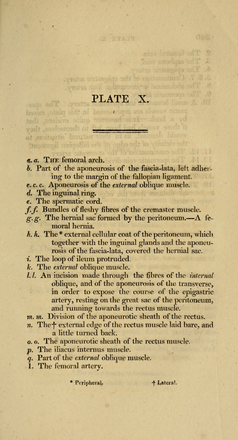 «. a. The femoral arch. b. Part of the aponeurosis of the fascia-lata, left adhei ing to the margin of the fallopian ligament. e. c. c. Aponeurosis of the external oblique muscle. d. The inguinal ring. €. The spermatic cord, f.f. Bundles of fleshy fibres of the cremaster muscle. g. g. The hernial sac formed by the peritoneum.—A fe- moral hernia. h, h. The * external cellular coat of the peritoneum, which together with the inguinal glands and the aponeu- rosis of the fascia-lata, covered the hernial sac. i. The loop of ileum protruded, k. The external oblique muscle. /. /. An incision made through the fibres of the internal oblique, and of the aponeurosis of the transverse, in order to expose the course of the epigastric artery, resting on the great sac of the peritoneum, and running towards the rectus muscle. m. m. Division of the aponeurotic sheath of the rectus. n. The I external edge of the rectus muscle laid bare, and a little turned back. 0. o. The aponeurotic sheath of the rectus muscle. p. The iliacus internus muscle. q. Part of the external oblique muscle. 1. The femoral artery. * Peripheral. -f Lateral.