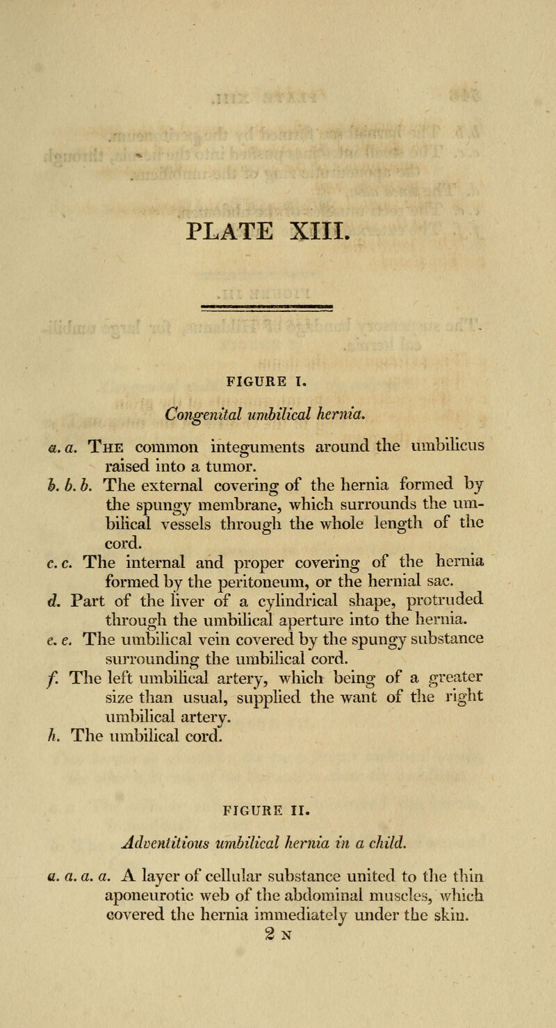 FIGURE T. Congenital umbilical hernia, a. a. The common integuments around the umbilicus raised into a tumor. h. b. b. The external covering of the hernia formed by the spungy membrane, which surrounds the um- bilical vessels through the whole length of the cord. c,c. The internal and proper covering of the hernia formed by the peritoneum, or the hernial sac. d. Part of the liver of a cylindrical shape, protruded through the umbilical aperture into the hernia. e. e. The umbilical vein covered by the spungy substance surrounding the umbilical cord. f. The left umbilical artery, which being of a greater size than usual, supplied the want of the right umbilical artery. h. The umbilical cord. FIGURE II. Adventitious umbilical hernia in a child. a. a. a. a. A layer of cellular substance united to tlie thin aponeurotic web of the abdominal muscles, which covered the hernia immediately under the skin. 2n