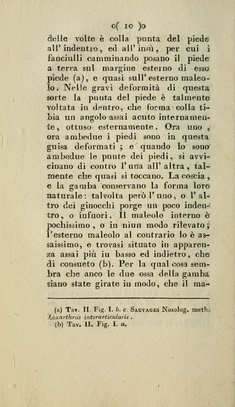 delle volte è colla punta del piede all'indentro, ed all' insù, per cui i fanciulli camminando posano il piede a terra sul margine esterno di esso piede (a), e quasi sull'esterno maleo- lo. Nelle gravi deformità di questa sorte la punta del piede è talmente voltata in dentro, che forma colla ti- bia un angol^assai acuto internamen- te, ottuso esternamente. Ora uno 9 ora ambedue i piedi sono in questa guisa deformati ; e quando lo sono ambedue le punte dei piedi, si avvi- cinano di contro l'una all'altra, tal- mente che quasi si toccano. La coscia , e la gamba conservano la forma loro naturale: talvolta però l'uno, o l'al- tro dei ginocchi porge un poco inden- tro, o infuori. Il maleolo interno è pochissimo, o in nìun modo rilevato; l'esterno maleolo al contrario lo è as- saissimo, e trovasi situato in apparen- za assai più in basso ed indietro, che di consueto (b). Per la qual cosa sem- bra che anco le due ossa della gamba siano state girate iti modo, che il ma- la) Tav. IL Fig. I. b. e Sauvages Nosolog. meth; Loxarihrus interarticularis .