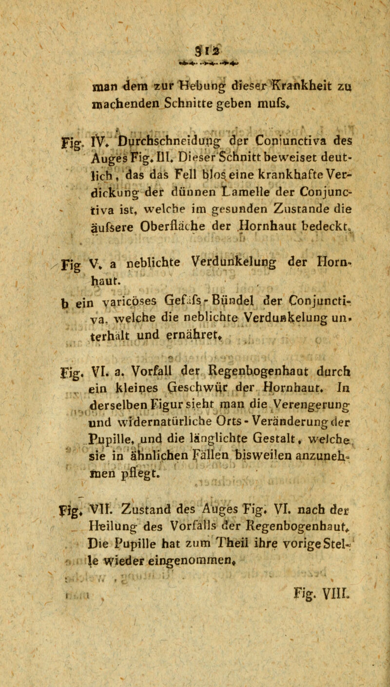 3ia Kfcdk» .->.<.. ->*L> man dem zur Hebung dieser Krankheit zu machenden Schnitte geben mufs* Flg- IV* 'Durchschneidung der Coniunctiva des Auges Fig* III. Dieser Schnitt beweiset deut- lich , das das Fell blos eine krankhafte Ver- dickung der dünnen Lamelle der Conjunc- tiva ist, welche im gesunden Zustande die aufsere Oberfläche der Hornhaut bedeckt, Fig V* a neblichte Verdunkelung der Horn- haut. b ein varicöses Geflfs-Bündel der Conjuncti- va. welche die neblichte Verduß^elung un» terhalt und ernähret* Fig. VI. a. Vorfall der Regenbogenhaut durch ein kleines Geschwür der Hornhaut. In derselben Figur sieht man die Verengerung und widernatürliche Orts-Veränderung der Pupille, und die länglichte Gestalt, welche sie in ähnlichen fällen bisweilen anzuneh- men pflegt. flg. VII. Zustand des Auges Fig. VI. nach der Pfeilung des Vorfalls der Regenbogenhaut, Die Pupille hat zum Theil ihre vorige Stel* le Wieder eingenommen* Fig. VUL