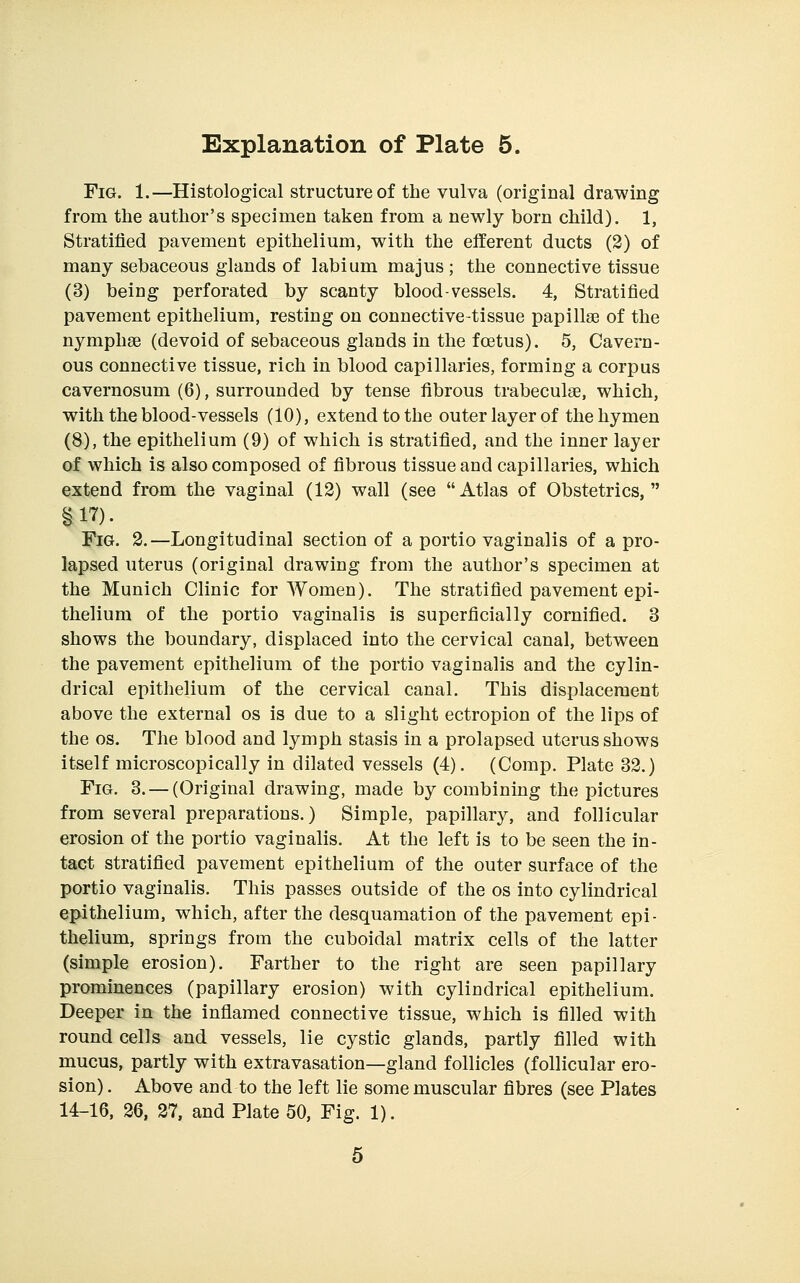 Fig. 1.—Histological structure of the vulva (original drawing from the author's specimen taken from a newly born child). 1, Stratified pavement epithelium, with the efferent ducts (2) of many sebaceous glands of labium majus ; the connective tissue (3) being perforated by scanty blood-vessels. 4, Stratified pavement epithelium, resting on connective-tissue papillae of the nymphse (devoid of sebaceous glands in the foetus). 5, Cavern- ous connective tissue, rich in blood capillaries, forming a corpus cavernosum (6), surrounded by tense fibrous trabeculae, which, with the blood-vessels (10), extend to the outer layer of the hymen (8), the epithelium (9) of which is stratified, and the inner layer of which is also composed of fibrous tissue and capillaries, which extend from the vaginal (12) wall (see Atlas of Obstetrics, Fig. 3.—Longitudinal section of a portio vaginalis of a pro- lapsed uterus (original drawing from the author's specimen at the Munich Clinic for Women). The stratified pavement epi- thelium of the portio vaginalis is superficially cornified. 3 shows the boundary, displaced into the cervical canal, between the pavement epithelium of the portio vaginalis and the cylin- drical epithelium of the cervical canal. This displacement above the external os is due to a slight ectropion of the lips of the OS. The blood and lymph stasis in a prolapsed uterus shows itself microscopically in dilated vessels (4). (Comp. Plate 32.) Fig. 3. — (Original drawing, made by combining the pictures from several preparations.) Simple, papillary, and follicular erosion of the portio vaginalis. At the left is to be seen the in- tact stratified pavement epithelium of the outer surface of the portio vaginalis. This passes outside of the os into cylindrical epithelium, which, after the desquamation of the pavement epi- thelium, springs from the cuboidal matrix cells of the latter (simple erosion). Farther to the right are seen papillary prominences (papillary erosion) with cylindrical epithelium. Deeper in the inflamed connective tissue, which is filled with round cells and vessels, lie cystic glands, partly filled with mucus, partly with extravasation—gland follicles (follicular ero- sion) . Above and to the left lie some muscular fibres (see Plates 14-16, 26, 27, and Plate 50, Fig. 1).
