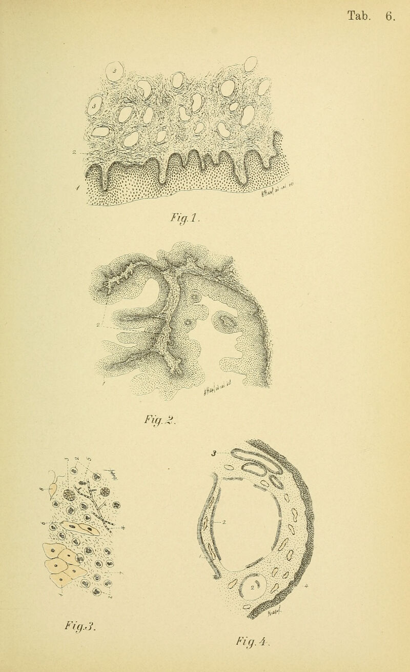 ■^\ Tig.l. m.<^ Fi(j.^,. pi^ Tab. 6. Fig.3.