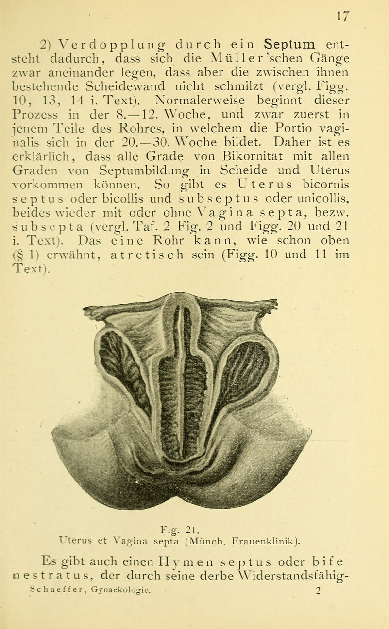 2)\^erdopplung durch ein Septum ent- steht dadurch, dass sich die Müll er'sehen Gänge zwar aneinander legen, dass aber die zwischen ihnen bestehende Scheidewand nicht schmilzt (vergl. Figg. 10, 13, 14 i. Text). Normalerweise beginnt dieser Prozess in der 8.—12. Woche, und zwar zuerst in jenem Teile des Rohres, in welchem die Portio vagi- nalis sich in der 20. —30. Woche bildet. Daher ist es erklärlich, dass -alle Grade von Bikornität mit allen Graden von Septumbildung in Scheide und Uterus vorkommen könne n. So gibt es Uterus bicornis septus oder bicollis und subseptus oder unicollis, beides wieder mit oder ohne Vagina septa, bezw. subsepta (vergl. Taf. 2 Fig. 2 und Figg. 20 und 21 i. Text). Das eine Rohr kann, wie schon oben {§ 1) erwähnt, atretisch sein (Figg. 10 und 11 im Text). Fig. 21. L terus et \ agina septa (Münch. Frauenklinik). Es gibt auch einen H v m e n septus oder b i f e nestratus, der durch seine derbe Widerstandsfähig- Schaeffer, Gjnaekolog-ie. 2