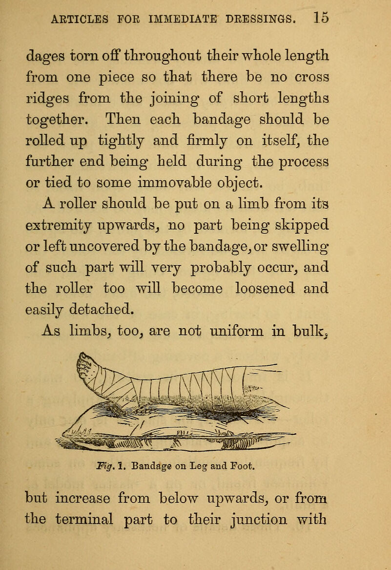 dages torn off throughout their whole length from one piece so that there be no cross ridges from the joining of short lengths together. Then each bandage should be rolled up tightly and firmly on itself^ the further end being held during the process or tied to some immovable object. A roller should be put on a limb from its extremity upwards^ no part being skipped or left uncovered by the bandage^ or swelling of such part will very probably occur^ and the roller too wiU become loosened and easily detached. As limbsj too^ are not uniform in bulk^ Fig. 1, Bandage on Leg and Foot. but increase from below upwards,, or from the terminal part to their junction with