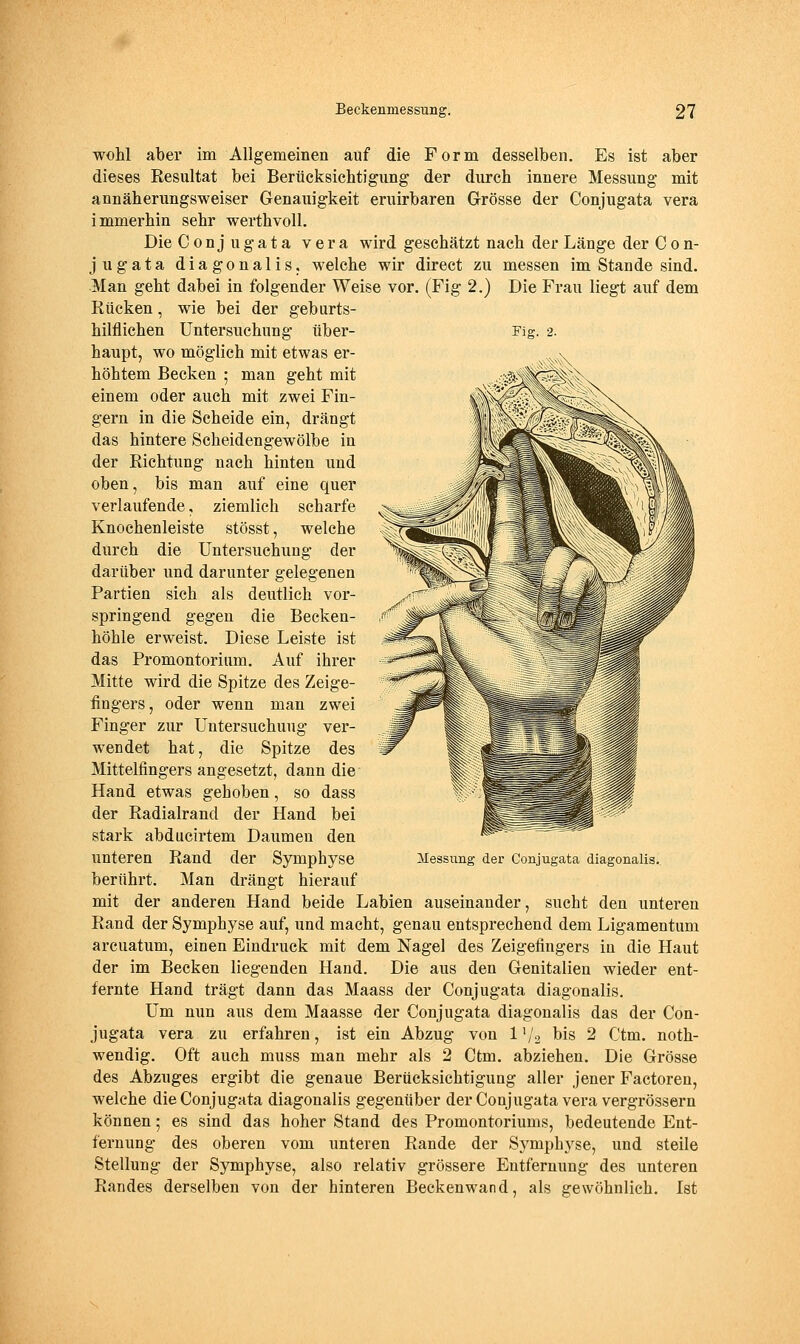 wohl aber im Allgemeinen auf die Form desselben. Es ist aber dieses Resultat bei Berücksichtigung der durch innere Messung mit annäherungsweiser Genauigkeit eruirbaren Grösse der Conjugata vera immerhin sehr werthvoll. Die Conjugata vera wird geschätzt nach der Länge der Con- jugata diagonalis, welche wir direct zu messen im Stande sind. Man geht dabei in folgender Weise vor. (Fig 2.) Die Frau liegt auf dem Rücken, wie bei der geburts- hilflichen Untersuchung über- Fig. 2. haupt, wo möglich mit etwas er- höhtem Becken ; man geht mit einem oder auch mit zwei Fin- gern in die Scheide ein, drängt das hintere Scheidengewölbe in der Richtung nach hinten und oben, bis man auf eine quer verlaufende, ziemlich scharfe Knochenleiste stösst, welche durch die Untersuchung der darüber und darunter gelegenen Partien sich als deutlich vor- springend gegen die Becken- höhle erweist. Diese Leiste ist das Promontorium. Auf ihrer Mitte wird die Spitze des Zeige- fingers, oder wenn man zwei Finger zur Untersuchung ver- wendet hat, die Spitze des Mittelfingers angesetzt, dann die Hand etwas gehoben, so dass der Radialrand der Hand bei stark abducirtem Daumen den unteren Rand der Symphyse berührt. Man drängt hierauf mit der anderen Hand beide Labien auseinander, sucht den unteren Rand der Symphyse auf, und macht, genau entsprechend dem Ligamentum arcuatum, einen Eindruck mit dem Nagel des Zeigefingers in die Haut der im Becken liegenden Hand. Die aus den Genitalien wieder ent- fernte Hand trägt dann das Maass der Conjugata diagonalis. Um nun aus dem Maasse der Conjugata diagonalis das der Con- jugata vera zu erfahren, ist ein Abzug von 1V2 t)is 2 Ctm. noth- wendig. Oft auch muss man mehr als 2 Ctm. abziehen. Die Grösse des Abzuges ergibt die genaue Berücksichtigung aller jeuer Factoren, welche die Conjugata diagonalis gegenüber der Conjugata vera vergrössern können; es sind das hoher Stand des Promontoriums, bedeutende Ent- fernung des oberen vom unteren Rande der Symphj^se, und steile Stellung der Symphyse, also relativ grössere Entfernung des unteren Randes derselben von der hinteren Beckenwand, als gewöhnlich. Ist Messung der Conjugata diagonalis..