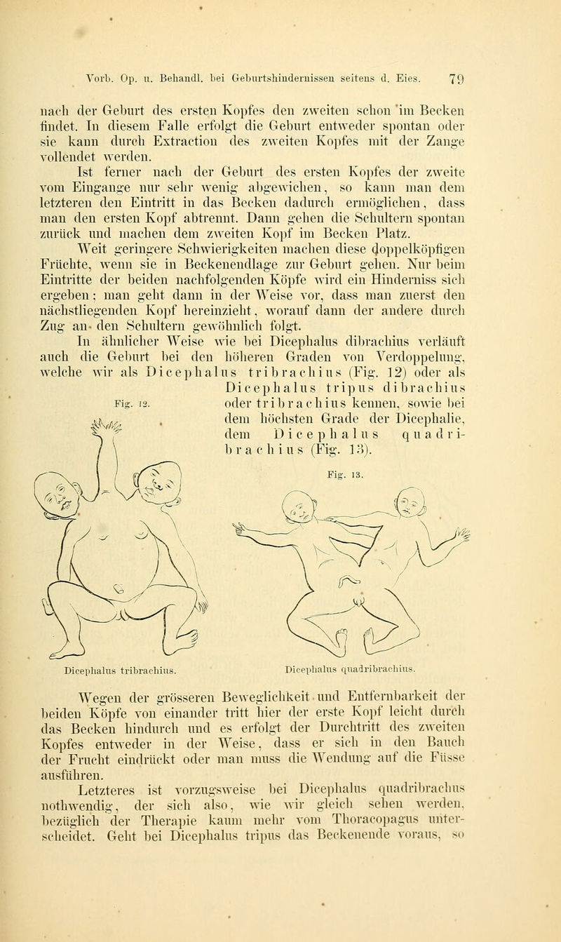 nach der Geburt des ersten Kopfes den zweiten sclion 'im Becken findet. In diesem Falle erfolgt die Geburt entweder spontan oder sie kann durch Extraction des zweiten Kopfes mit der Zange vollendet werden. Ist ferner nach der Geburt des ersten Kopfes der zweite vom Eingange nur sehr wenig abgewichen, so kann man dem letzteren den Eintritt in das Becken dadurch ermöglichen, dass man den ersten Kopf abtrennt. Dann gehen die Schultern spontan zurück und machen dem zweiten Kopf im Becken Platz. Weit geringere Schwierigkeiten machen diese (Joppelköpfigen Früchte, wenn sie in Beckenendlage zur Geburt gehen. Nur beim Eintritte der beiden nachfolgenden Köpfe wird ein Hinderniss sich ergeben: man geht dann in der Weise vor, dass man zuerst den nächstliegenden Kopf hereinzieht, worauf dann der andere durch Zug an- den Schultern gewöhnlich folgt. In ähnlicher Weise wie bei Dicephalus dil)rachius verläuft auch die Geburt bei den höheren Graden von Verdoppelung, welche wir als Dicephalus t r i b r a c h i u s (Fig. ] 2) oder als Dicephalus t r i p u s d i b r a c h i u s Fig. 12. oder tribrachius kennen, sowie bei dem höchsten Grade der Dicephalie, dem Dicephalus q u a d r i- 1) r a c h i u s (Fig. 13). Diceplialus tribrachius. Diceplialus qiiadribrachius. Wegen der grösseren Beweglichkeit und Entfernbarkeit der beiden Köpfe von einander tritt hier der erste Kopf leicht durch das Becken hindurch und es erfolgt der Durchtritt des zweiten Kopfes entweder in der Weise, dass er sich in den Bauch der Frucht eindrückt oder man muss die Wendung auf die Füsse ausführen. Letzteres ist vorzugsweise bei Dicephalus quadril)rachus nothwendig, der sich also, wie wir gleich sehen werden, bezüglich der Therapie kaum mehr vom Thoracopagus unter- scheidet. Geht bei Dicephalus tripus das Beckenende voraus, so