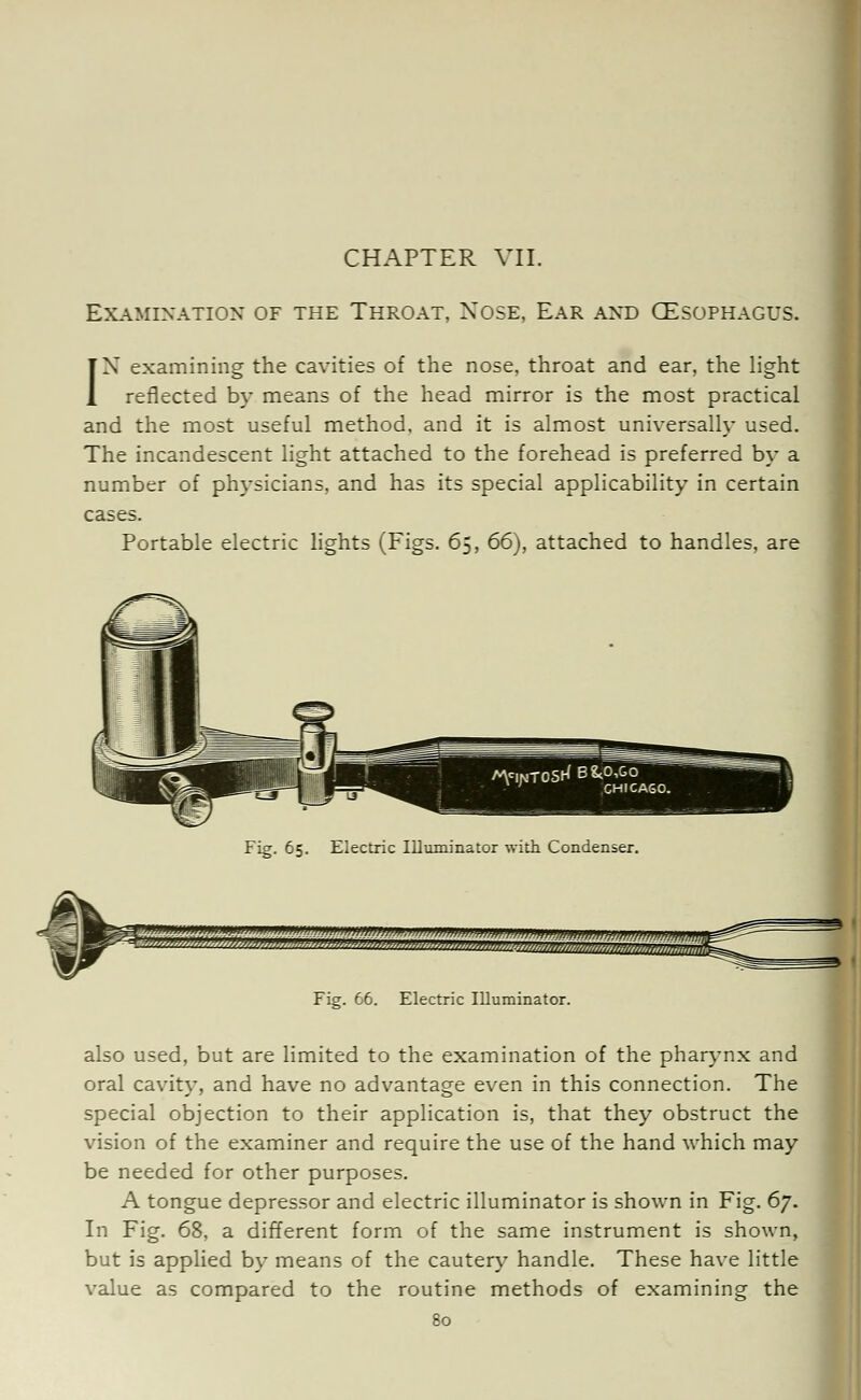 CHAPTER VII. Examination of the Throat, Xose, Ear and CEsophagus. IN examining the cavities of the nose, throat and ear, the light reflected by means of the head mirror is the most practical and the most useful method, and it is almost universally used. The incandescent light attached to the forehead is preferred by a number of physicians, and has its special applicability in certain cases. Portable electric lights (Figs. 65, 66), attached to handles, are Fig. 65. Electric Illuminator with Condenser. Fig. 66. Electric Illuminator. also used, but are limited to the examination of the pharynx and oral cavity, and have no advantage even in this connection. The special objection to their application is, that they obstruct the vision of the examiner and require the use of the hand which may be needed for other purposes. A tongue depressor and electric illuminator is shown in Fig. 6j. In Fig. 68, a different form of the same instrument is shown, but is applied by means of the cautery handle. These have little value as compared to the routine methods of examining the