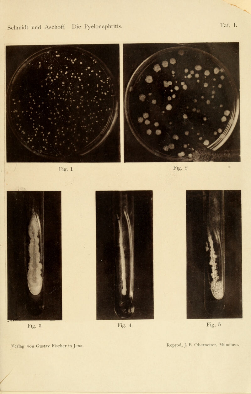 Schmidt und Aschoff. Die Pyelonephritis. Taf. I. Fig. 1 Fig. 2 Fig. 3 Fig. 4 Fig. 5 Verlag von Gustav Fischer in Jena. Reprod. J. B. Obernetter, München.