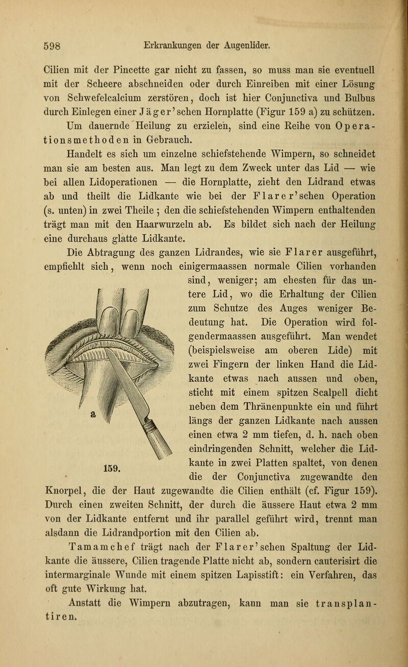 Cilien mit der Pincette gar nicht zu fassen, so muss man sie eventuell mit der Scheere abschneiden oder durch Einreiben mit einer Lösung von Schwefelcalcium zerstören, doch ist hier Conjunctiva und Bulbus durch Einlegen einer Jag er'sehen Hornplatte (Figur 159 a) zu schützen. Um dauernde Heilung zu erzielen, sind eine Reihe von Opera- tionsmethoden in Gebrauch. Handelt es sich um einzelne schiefstehende Wimpern, so schneidet man sie am besten aus. Man legt zu dem Zweck unter das Lid — wie bei allen Lidoperationen — die Hornplatte, zieht den Lidrand etwas ab und theilt die Lidkante wie bei der Flarer'sehen Operation (s. unten) in zwei Theile ; den die schiefstehenden Wimpern enthaltenden trägt man mit den Haarwurzeln ab. Es bildet sich nach der Heilung eine durchaus glatte Lidkante. Die Abtragung des ganzen Lidrandes, wie sie Flar er ausgeführt, empfiehlt sich, wenn noch einigermaassen normale Cilien vorhanden sind, weniger; am ehesten für das un- tere Lid, wo die Erhaltung der Cilien zum Schutze des Auges weniger Be- deutung hat. Die Operation wird fol- gendermaassen ausgeführt. Man wendet (beispielsweise am oberen Lide) mit zwei Fingern der linken Hand die Lid- kante etwas nach aussen und oben, sticht mit einem spitzen Scalpell dicht neben dem Thränenpunkte ein und führt längs der ganzen Lidkante nach aussen einen etwa 2 mm tiefen, d. h. nach oben eindringenden Schnitt, welcher die Lid- kante in zwei Platten spaltet, von denen die der Conjunctiva zugewandte den Knorpel, die der Haut zugewandte die Cilien enthält (cf. Figur 159). Durch einen zweiten Schnitt, der durch die äussere Haut etwa 2 mm von der Lidkante entfernt und ihr parallel geführt wird, trennt man alsdann die Lidrandportion mit den Cilien ab. Tamamchef trägt nach der Flar er'sehen Spaltung der Lid- kante die äussere, Cilien tragende Platte nicht ab, sondern cauterisirt die intermarginale Wunde mit einem spitzen Lapisstift: ein Verfahren, das oft gute Wirkung hat. Anstatt die Wimpern abzutragen, kann man sie transplan- tiren. 159.