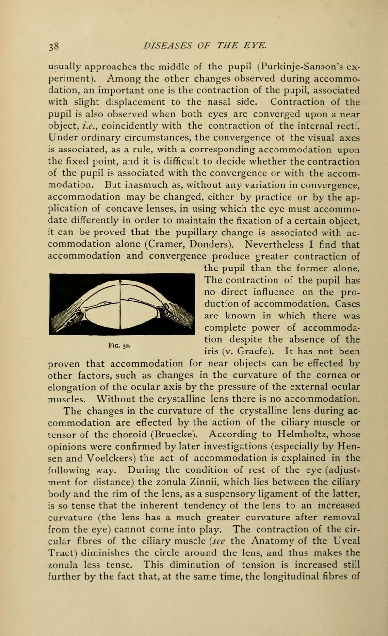 usually approaches the middle of the pupil (Purkinje-Sanson's ex- periment). Among the other changes observed during accommo- dation, an important one is the contraction of the pupil, associated with slight displacement to the nasal side. Contraction of the pupil is also observed when both eyes are converged upon a near object, i.e., coincidently with the contraction of the internal recti. Under ordinary circumstances, the convergence of the visual axes is associated, as a rule, with a corresponding accommodation upon the fixed point, and it is difficult to decide whether the contraction of the pupil is associated with the convergence or with the accom- modation. But inasmuch as, without any variation in convergence, accommodation may be changed, either by practice or by the ap- plication of concave lenses, in using which the eye must accommo- date differently in order to maintain the fixation of a certain object, it can be proved that the pupillary change is associated with ac- commodation alone (Cramer, Donders). Nevertheless I find that accommodation and convergence produce greater contraction of the pupil than the former alone. The contraction of the pupil has no direct influence on the pro- duction of accommodation. Cases are known in which there was complete power of accommoda- tion despite the absence of the Fig. 32. ••//~»r\Ti iris (v. Graefe). It has not been proven that accommodation for near objects can be effected by other factors, such as changes in the curvature of the cornea or elongation of the ocular axis by the pressure of the external ocular muscles. Without the crystalline lens there is no accommodation. The changes in the curvature of the crystalline lens during ac- commodation are effected by the action of the ciliary muscle or tensor of the choroid (Bruecke). According to Helmholtz, whose opinions were confirmed by later investigations (especially by Hen- sen and Voelckers) the act of accommodation is explained in the following way. During the condition of rest of the eye (adjust- ment for distance) the zonula Zinnii, which lies between the ciliary body and the rim of the lens, as a suspensory ligament of the latter, is so tense that the inherent tendency of the lens to an increased curvature (the lens has a much greater curvature after removal from the eye) cannot come into play. The contraction of the cir- cular fibres of the ciliary muscle (see the Anatomy of the Uveal Tract) diminishes the circle around the lens, and thus makes the zonula less tense. This diminution of tension is increased still further by the fact that, at the same time, the longitudinal fibres of