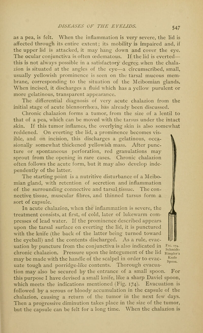 as a pea, is felt. When the inflammation is very severe, the lid is affected through its entire extent; its mobility is impaired and, if the upper lid is attacked, it may hang down and cover the eye. The ocular conjunctiva is often (Edematous. If the lid is everted— this is not always possible in a satisfactory degree when the chala- zion is situated at the angles of the eye—a circumscribed, small, usually yellowish prominence is seen on the tarsal mucous mem- brane, corresponding to the situation of the Meibomian glands. When incised, it discharges a fluid which has a yellow purulent or more gelatinous, transparent appearance. The differential diagnosis of very acute chalazion from the initial stage of acute blennorrhea, has already been discussed. Chronic chalazion forms a tumor, from the size of a lentil to that of a pea, which can be moved with the tarsus under the intact skin. If this tumor inflames, the overlying skin is also somewhat reddened. On everting the lid, a prominence becomes vis- ible, and on incision, this discharges a gelatinous, occa- sionally somewhat thickened yellowish mass. After punc- ture or spontaneous perforation, red granulations may sprout from the opening in rare cases. Chronic chalazion often follows the acute form, but it ma)' also develop inde- pendently of the latter. The starting point is a nutritive disturbance of a Meibo- mian gland, with retention of secretion and inflammation of the surrounding connective and tarsal tissue. The con- nective tissue, muscular fibres, and thinned tarsus form a sort of capsule. In acute chalazion, when the inflammation is severe, the treatment consists, at first, of cold, later of lukewarm com- presses of lead water. If the prominence described appears upon the tarsal surface on everting the lid, it is punctured with the knife (the back of the latter being turned toward the eyeball) and the contents discharged. As a rule, evac- uation by puncture from the conjunctiva is also indicated in F,G- 74- .. f 1 i- 1 Schmidt- chronic chalazion. Pressure upon the integument of the lid Rimpiers may be made with the handle of the scalpel in order to evac- cKmfe J l Spoon. uate tough and porridge-like contents. Thorough evacua- tion may also be secured by the entrance of a small spoon. For this purpose I have devised a small knife, like a sharp Daviel spoon, which meets the indications mentioned (Fig. 174). Evacuation is followed by a serous or bloody accumulation in the capsule of the chalazion, causing a return of the tumor in the next few days. Then a progressive diminution takes place in the size of the tumor, but the capsule can be felt for a long time. When the chalazion is