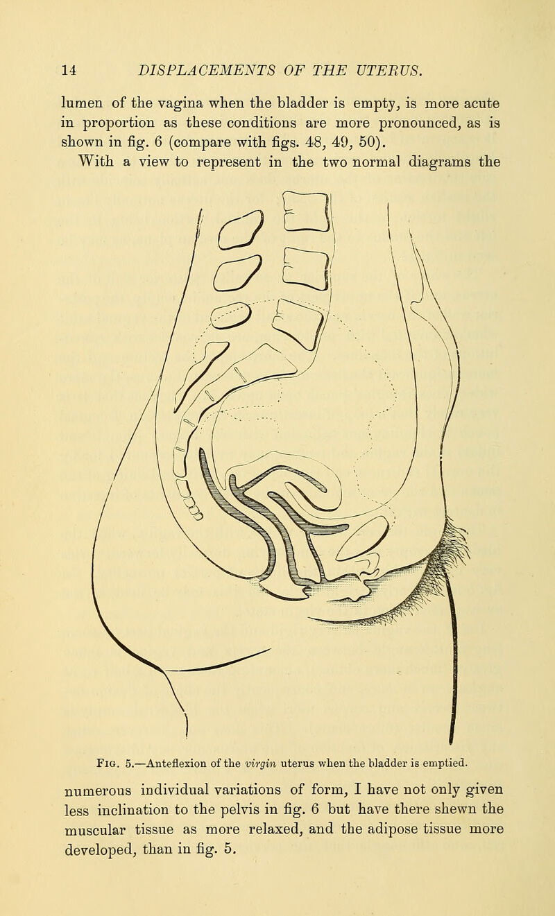 lumen of the vagina when the bladder is empty, is more acute in proportion as these conditions are more pronounced, as is shown in fig. 6 (compare with figs. 48, 49, 50). With a view to represent in the two normal diagrams the Fig. 5.—Anteflexion of the virgin uterus when the bladder is emptied. numerous individual variations of form, I have not only given less inclination to the pelvis in fig. 6 but have there shewn the muscular tissue as more relaxed, and the adipose tissue more developed, than in fig. 5.