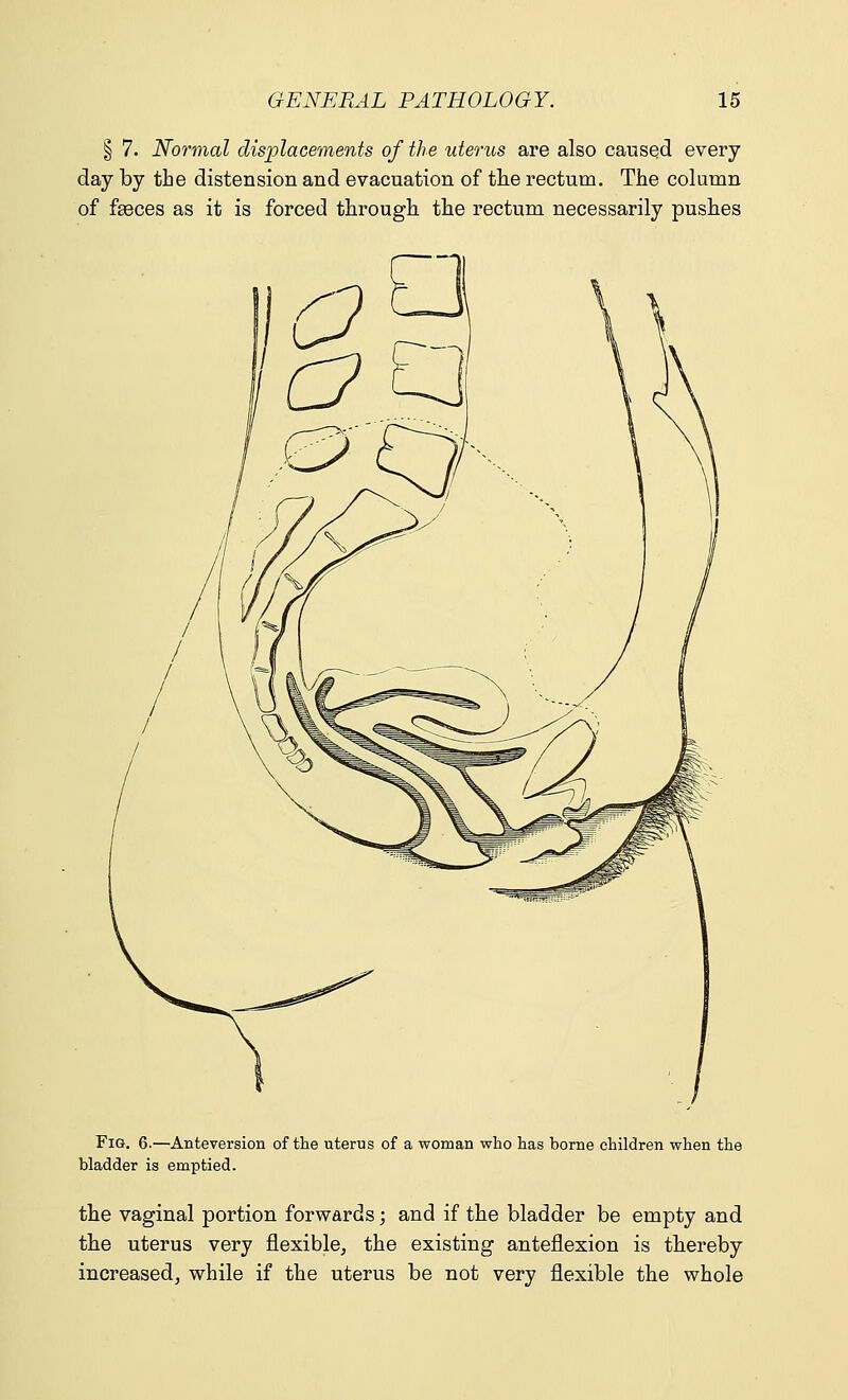 § 7. Normal displacements of the uterus are also caused every day by the distension and evacuation of the rectum. The column of faeces as it is forced through the rectum necessarily pushes Fig. 6.—Anteversion of the uterus of a woman who has borne children when the bladder is emptied. the vaginal portion forwards; and if the bladder be empty and the uterus very flexible, the existing anteflexion is thereby increased, while if the uterus be not very flexible the whole