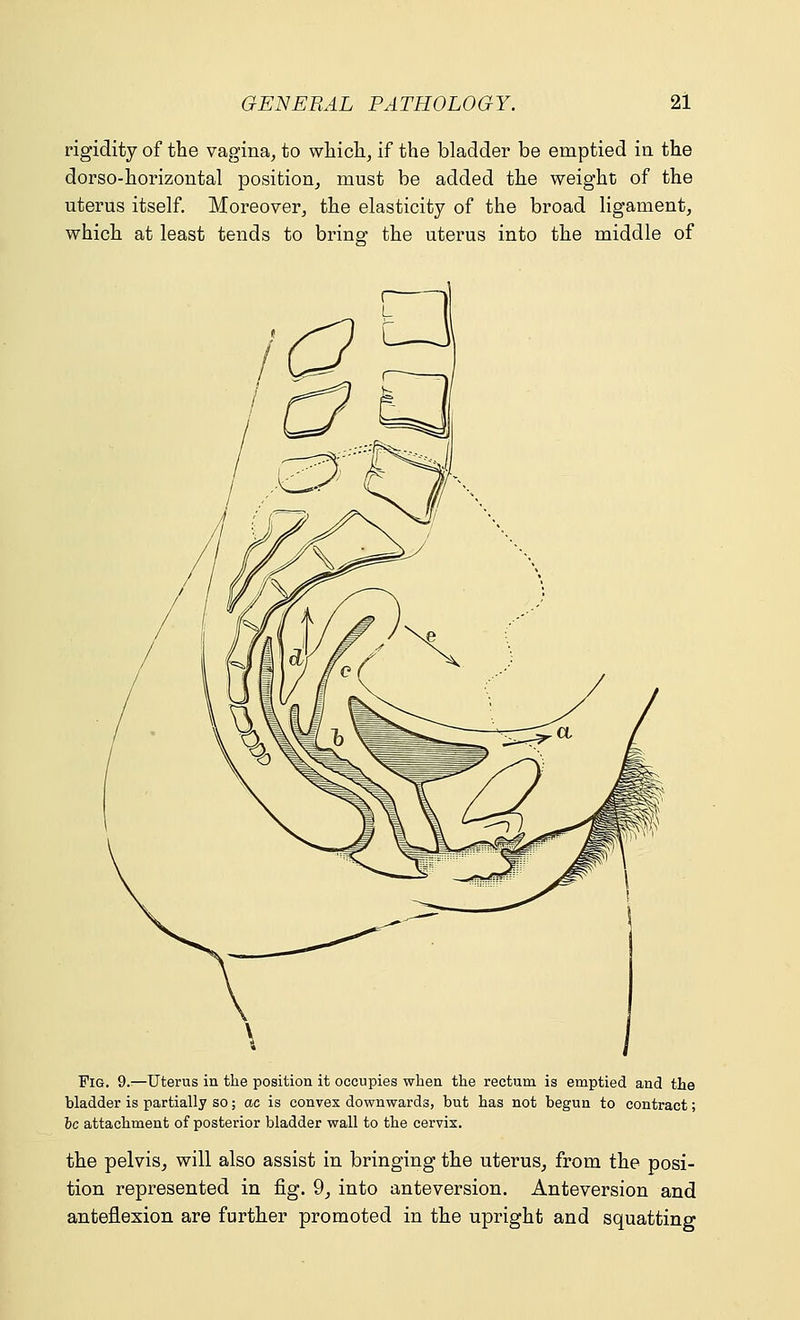 rigidity of the vagina, to which, if the bladder be emptied in the dorso-horizontal position, must be added the weight of the uterus itself. Moreover, the elasticity of the broad ligament, which at least tends to bring the uterus into the middle of Fig. 9.—Uterus in the position it occupies when the rectum is emptied and the bladder is partially so; ac is convex downwards, but has not begun to contract; he attachment of posterior bladder wall to the cervix. the pelvis, will also assist in bringing the uterus, from the posi- tion represented in fig. 9, into anteversion. Anteversion and anteflexion are further promoted in the upright and squatting