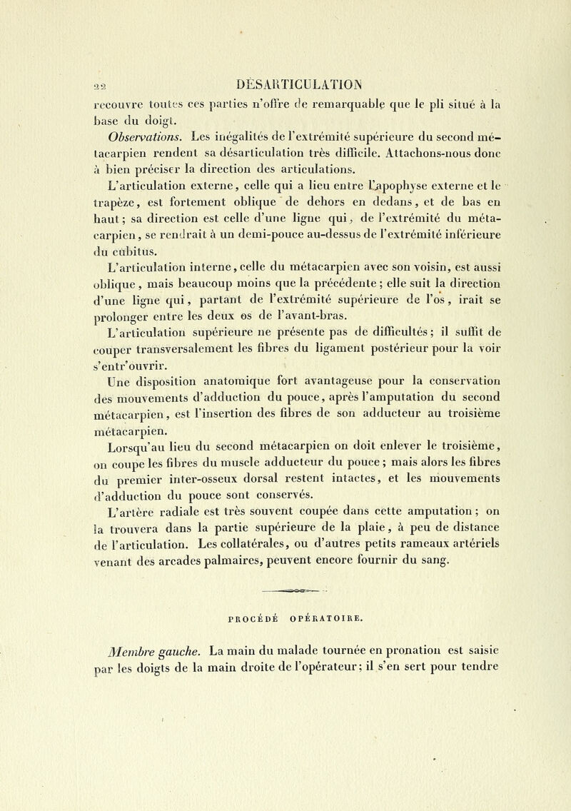 recouvre toutes ces parties n'ofire de remarquable que le pli situé à la base du doigt. Observations. Les inégalités de l'extrémité supérieure du second mé- tacarpien rendent sa désarticulation très difficile. Attachons-nous donc à bien préciser la direction des articulations. L'articulation externe, celle qui a lieu entre l!^pophyse externe et le trapèze, est fortement oblique de dehors en dedans, et de bas en haut; sa direction est celle d'une ligne quij, de l'extrémité du méta- carpien, se rendrait à un demi-pouce au-dessus de l'extrémité inférieure du cubitus. L'articulation interne,celle du métacarpien avec son voisin, est aussi oblique , mais beaucoup moins que la précédente ; elle suit la direction d'une ligne qui, partant de l'extrémité supérieure de l'os, irait se prolonger entre les deux os de l'avant-bras. L'articulation supérieure ne présente pas de difficultés; il suffit de couper transversalement les fibres du ligament postérieur pour la voir s'entr'ouvrir. Une disposition anatomique fort avantageuse pour la conservation des mouvements d'adduction du pouce, après l'amputation du second métacarpien, est l'insertion des fibres de son adducteur au troisième métacarpien. Lorsqu'au lieu du second métacarpien on doit enlever le troisième, on coupe les fibres du muscle adducteur du pouce ; mais alors les fibres du premier inter-osseux dorsal restent intactes, et les mouvements d'adduction du pouce sont conservés. L'artère radiale est très souvent coupée dans cette amputation ; on la trouvera dans la partie supérieure de la plaie, à peu de distance de l'articulation. Les collatérales, ou d'autres petits rameaux artériels venant des arcades palmaires, peuvent encore fournir du sang. PROCÉDÉ OPÉRATOIRE. Membre gauche. La main du malade tournée en pronation est saisie par les doigts de la main droite de l'opérateur; il s'en sert pour tendre