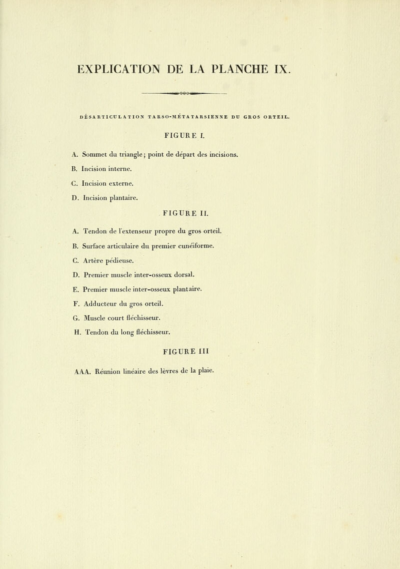 DÉSARTICULATION X A RSO-M ET A T ARSI EN N E DU GROS ORTEIL. FIGURE I. A. Sommet du triangle ; point de départ des incisions. B. Incision interne. C. Incision externe. D. Incision plantaire. FIGURE II. A. Tendon de l'extenseur propre du gros orteil. B. Surface articulaire du premier cunéiforme. C. Artère pédleuse. D. Premier muscle inter-osseux dorsal. E. Premier muscle inter-osseux plantaire. F. Adducteur du gros orteil. G. Muscle court fléchisseur. H. Tendon du long fléchisseur. FIGURE III