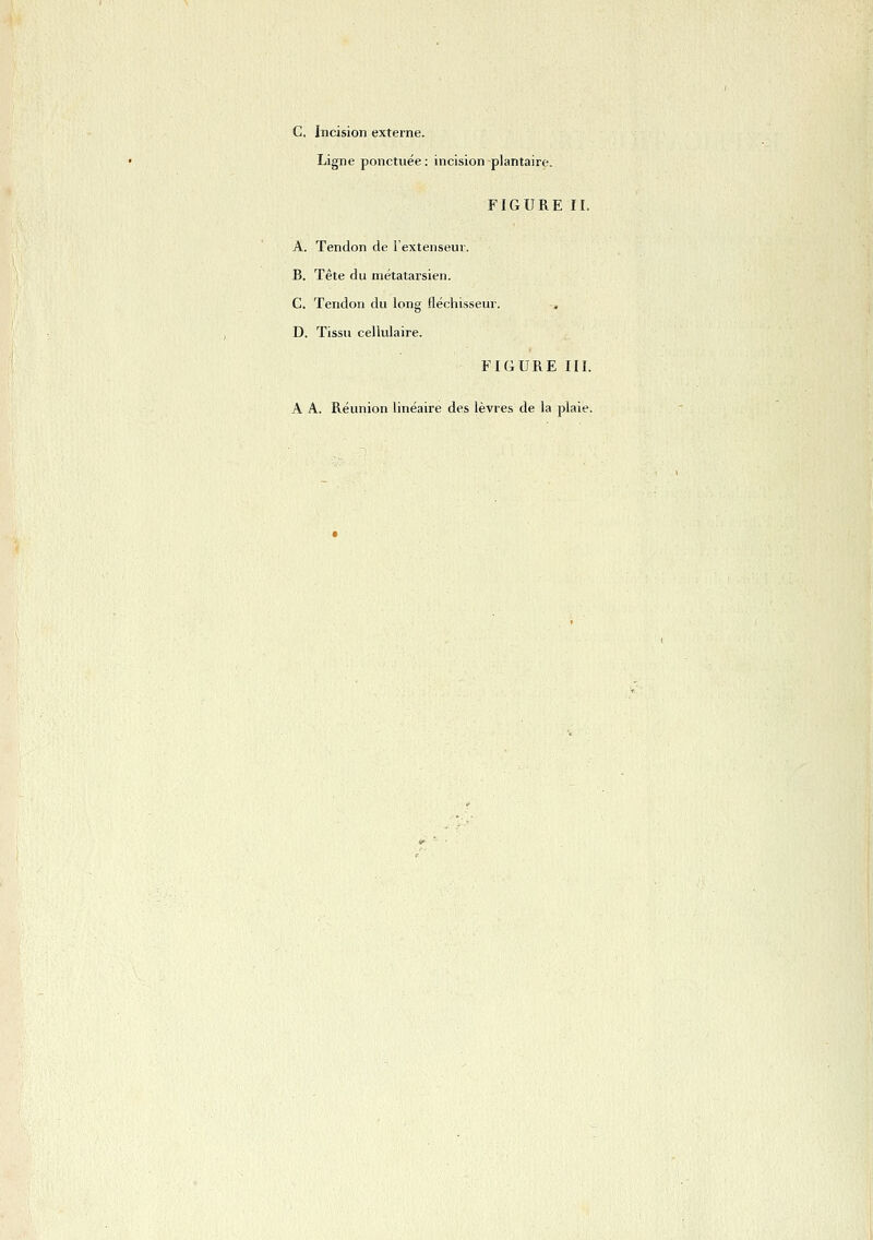 C. Incision externe. Ligne ponctuée : incision -plantaire. FIGURE IL A. Tendon de i'extenseur. B. Tête du métatarsien. C. Tendon du long fléchisseur. D. Tissu cellulaire. FIGURE IIL