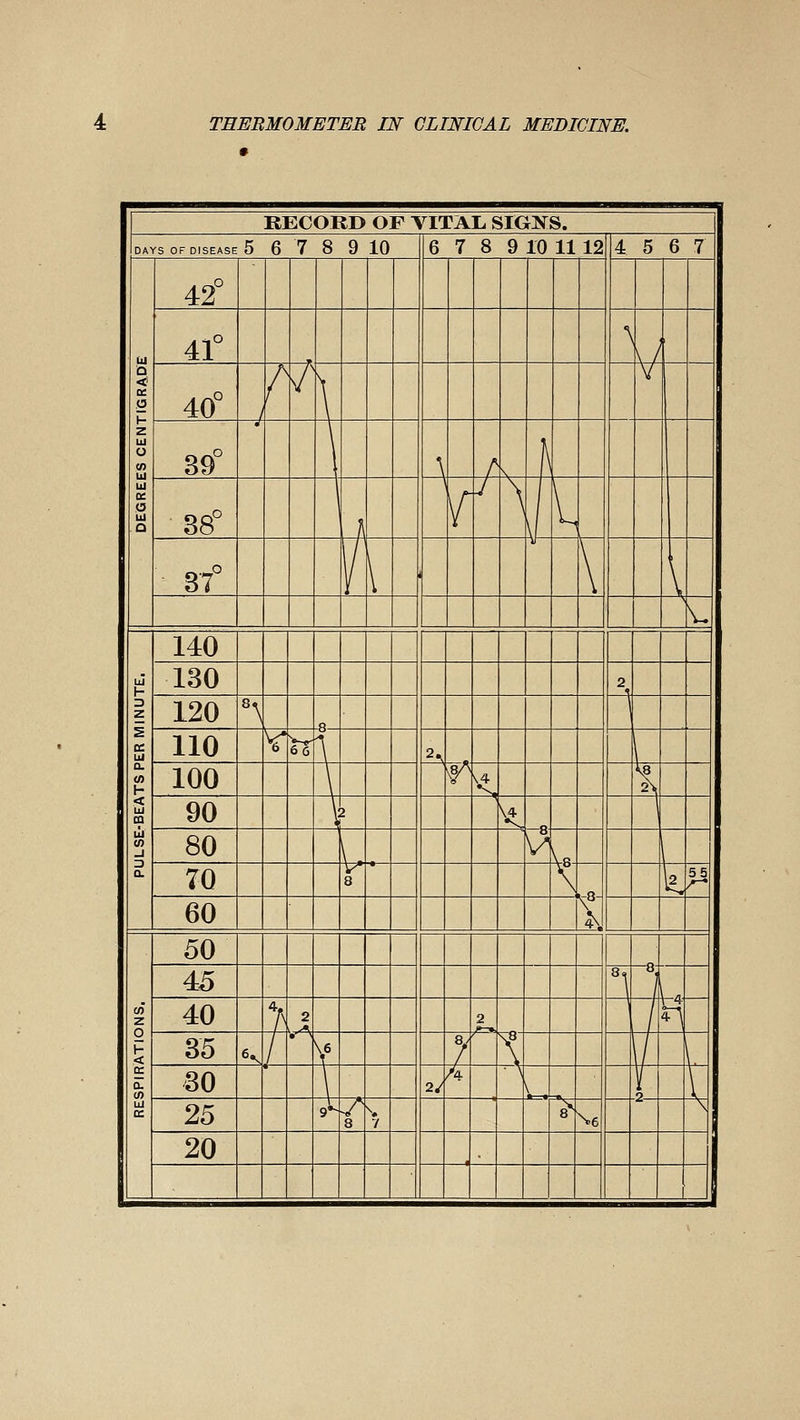 KECORD OF VITAL SIGNS. \\ DAYS OF DISEASE 5 6 7 8 9 10 6 7 8 9 10 11 12 4 5 6 7 1 % a 1- z UJ O w liJ UI a o UJ O 42° 41° *\ ^/ 40° / r / \ V 39° J \ / S h 38° \ A 1 ^ J \ 1 I ■ 37° ^ \ \ V \. z s ce UI 0. (0 h < UI m ÙJ _i Q. 140 130 2 120 \ 1 110 V ^n: ^ 2^ 100 \ ^ N ^ 90 \ 2 ^ 1 80 I d \c 1 70 8 ^ t \ ^^ 60 Z o < 0. CO UI 50 4 45 °1 \ 40 > 2 2 ' 35 K / Y 7 \8 \ L_ 30 2/ A \ .2 \ 25 ,1 8 7 > \6 ^ 20 -^