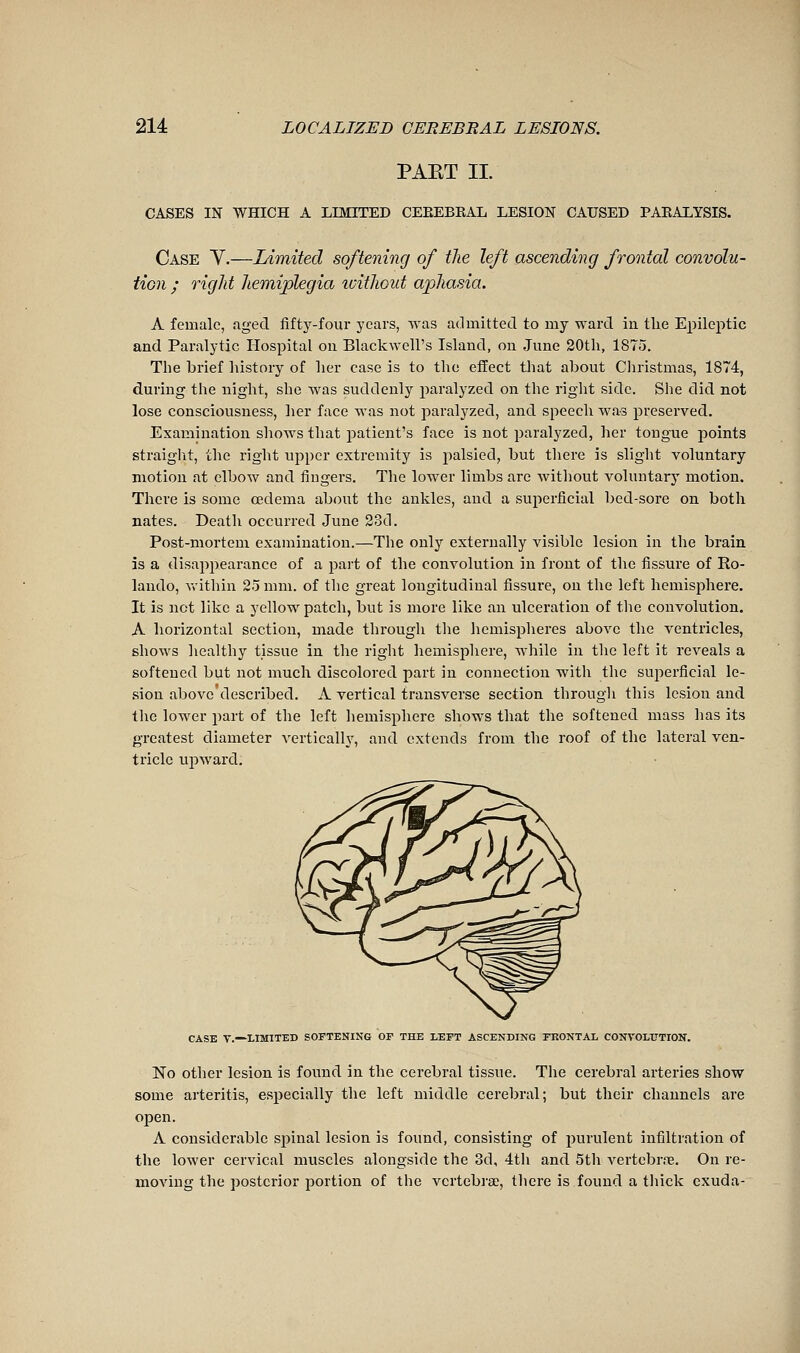 PAET II. CASES IN WHICH A LIMITED CEEEBRAL LESION CAUSED PAEALYSIS. Case Y.—Limited softening of the left ascending frontal convolu- tion ; right hemiplegia icithout aphasia. A female, aged fifty-four years, was admitted to my ward in the Epileptic and Paralytic Hospital on Blackwell's Island, on June 20th, 1875. The brief history of her case is to the effect tliat about Cliristmas, 1874, during the night, she was suddenly paralyzed on the right side. She did not lose consciousness, her face was not joaralyzed, and speech was preserved. Examination shows that patient's face is not paralyzed, her tongue points straight, the right upper extremity is palsied, but there is slight voluntary motion at elbow and fingers. The lower limbs are without voluntary motion. There is some oedema about the ankles, and a superficial bed-sore on both nates. Death occurred June 23d. Post-mortem examination.—The only externally visible lesion in the brain is a disapi^earance of a part of the convolution in front of the fissure of Ro- lando, v>'ithin 25 mm. of the great longitudinal fissure, on the left hemisphere. It is net like a yellow patch, but is more like an ulceration of the convolution. A horizontal section, made through the hemispheres above the ventricles, shows healthy tissue in the right hemisphere, while in the left it reveals a softened but not much discolored part in connection with the superficial le- sion above described. A vertical transverse section through this lesion and the lower part of the left liemisphere shows that the softened mass has its greatest diameter vertical!}', and extends from the roof of the lateral ven- tricle upward. CASE v.—LIMITED SOFTENING OF THE LEFT ASCENDING FEONTAL CONVOLUTION. No other lesion is found in the cerebral tissue. The cerebral arteries show some arteritis, especially the left middle cerebral; but their channels are open. A considerable spinal lesion is found, consisting of jiurulent infiltration of the lower cervical muscles alongside the 3d, 4th and 5th vertebrœ. On re- moving the posterior portion of the vertebra^, there is found a tliick exuda-