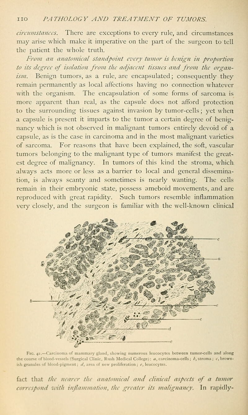 circumstances. There are exceptions to every rule, and circumstances may arise which make it imperative on the part of the surgeon to tell the patient the whole truth. From an anatomical standpoint every tumor is benign in proportion to its degree of isolation from the adjacent tissues and from the organ- ism. Benign tumors, as a rule, are encapsulated; consequently they remain permanently as local affections having no connection whatever with the organism. The encapsulation of some forms of sarcoma is more apparent than real, as the capsule does not afford protection to the surrounding tissues against invasion by tumor-cells; yet when a capsule is present it imparts to the tumor a certain degree of benig- nancy which is not observed in malignant tumors entirely devoid of a capsule, as is the case in carcinoma and in the most malignant varieties of sarcoma. For reasons that have been explained, the soft, vascular tumors belonging to the malignant type of tumors manifest the great- est degree of malignancy. In tumors of this kind the stroma, which always acts more or less as a barrier to local and general dissemina- tion, is always scanty and sometimes is nearly wanting. The cells remain in their embryonic state, possess ameboid movements, and are reproduced with great rapidity. Such tumors resemble inflammation very closely, and the surgeon is familiar with the well-known clinical I ig }• •—Carcinoma of mammary gland, showing numerous leucocytes between tumor-cells and along the course of blood-vessels (Surgical Clinic, Rush Medical College): a, carcinoma-cells ; ^.stroma; c, brown- ish granules of blood-pigment; </, area of new proliferation ; <*, leucocytes. fact that the nearer the anatomical and clinical aspects of a tumor correspond with inflammation^ the greater its malignancy. In rapidly-
