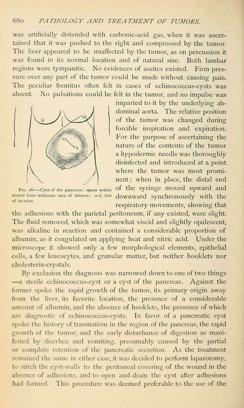 was artificially distended with carbonic-acid gas, when it was ascer- tained that it was pushed to the right and compressed by the tumor. The liver appeared to be unaffected by the tumor, as on percussion it was found in its normal location and of natural size. Both lumbar regions were tympanitic. No evidences of ascites existed. Firm pres- sure over any part of the tumor could be made without causing pain. The peculiar fremitus often felt in cases of echinococcus-cysts was absent. No pulsations could be felt in the tumor, and no impulse was imparted to it by the underlying ab- dominal aorta. The relative position of the tumor was changed during forcible inspiration and expiration. For the purpose of ascertaining the nature of the contents of the tumor a hypodermic needle was thoroughly disinfected and introduced at a point where the tumor was most promi- nent ; when in place, the distal end Fig. 462-Cyst of the pancreas: space 'within °f the Syringe moved Upward and dotted lines indicates area of dulness; a-b, line downward Synchronously With the of incision. respiratory movements, showing that the adhesions with the parietal peritoneum, if any existed, were slight. The fluid removed, which was somewhat viscid and slightly opalescent, was alkaline in reaction and contained a considerable proportion of albumin, as it coagulated on applying heat and nitric acid. Under the microscope it showed only a few morphological elements, epithelial cells, a few leucocytes, and granular matter, but neither hooklets nor cholesterin-crystals. By exclusion the diagnosis was narrowed down to one of two things —a sterile echinococcus-cyst or a cyst of the pancreas. Against the former spoke the rapid growth of the tumor, its primary origin away from the liver, its favorite location, the presence of a considerable amount of albumin, and the absence of hooklets, the presence of which are diagnostic of echinococcus-cysts. In favor of a pancreatic cyst spoke the history of traumatism in the region of the pancreas, the rapid growth of the tumor, and the early disturbance of digestion as mani- fested by diarrhea and vomiting, presumably caused by the partial or complete retention of the pancreatic secretion. As the treatment remained the same in either case, it was decided to perform laparotomy, to -titch the cyst-walls to the peritoneal covering of the wound in the absence of adhesions, and to open and drain the cyst after adhesions had formed. This procedure was deemed preferable to the use of the