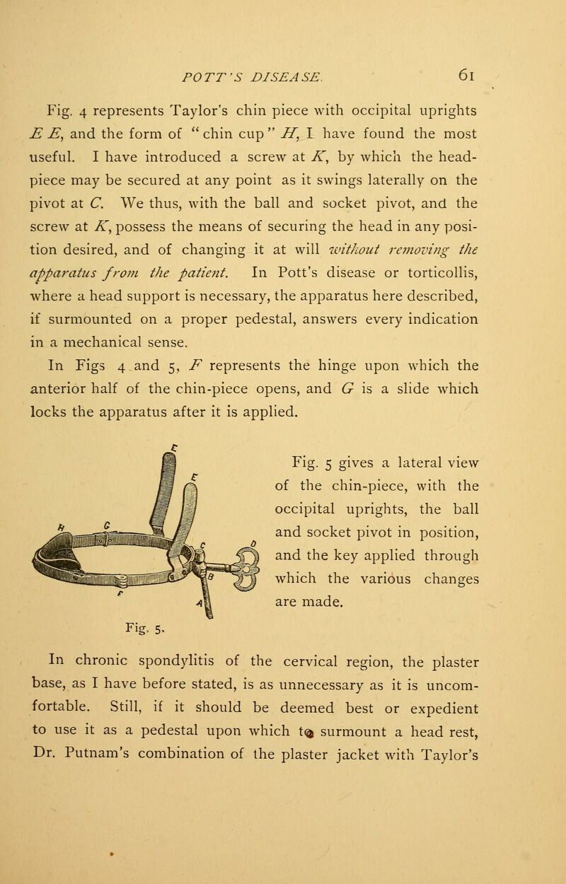 Fig. 4 represents Taylor's chin piece with occipital uprights E jE, and the form of  chin cup  H, I have found the most useful, I have introduced a screw at K, by which the head- piece may be secured at any point as it swings laterally on the pivot at C. We thus, with the ball and socket pivot, and the screw at K, possess the means of securing the head in any posi- tion desired, and of changing it at will ivithout removing the apparatus from the patient. In Pott's disease or torticollis, where a head support is necessary, the apparatus here described, if surmounted on a proper pedestal, answers every indication in a mechanical sense. In Figs 4 and 5, F represents the hinge upon which the anterior half of the chin-piece opens, and 6^ is a slide which locks the apparatus after it is applied. Fig, 5> Fig. 5 gives a lateral view of the chin-piece, with the occipital uprights, the ball and socket pivot in position, and the key applied through which the various changes are made. In chronic spondylitis of the cervical region, the plaster base, as I have before stated, is as unnecessary as it is uncom- fortable. Still, if it should be deemed best or expedient to use it as a pedestal upon which X% surmount a head rest, Dr. Putnam's combination of the plaster jacket with Taylor's