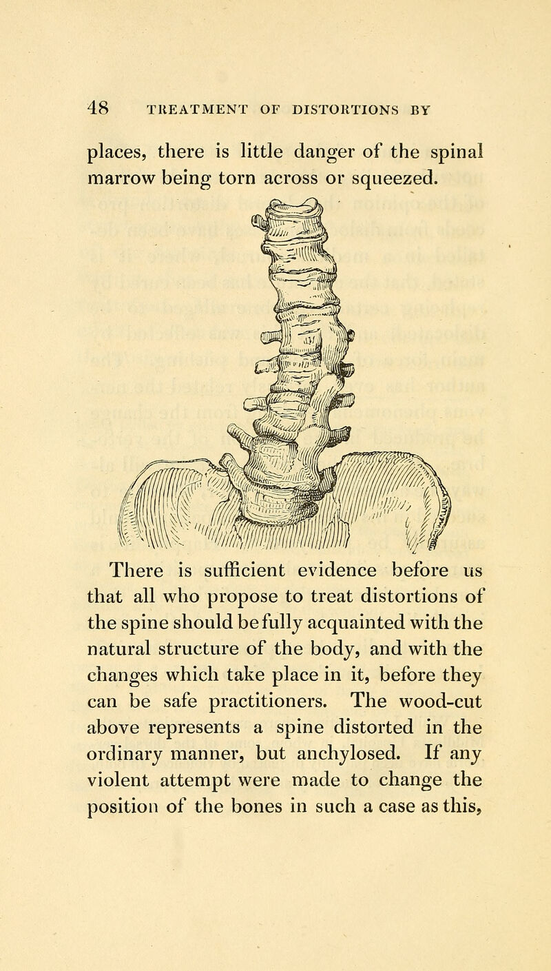 places, there is little danger of the spinal marrow being torn across or squeezed. There is sufficient evidence before us that all who propose to treat distortions of the spine should be fully acquainted with the natural structure of the body, and with the changes which take place in it, before they can be safe practitioners. The wood-cut above represents a spine distorted in the ordinary manner, but anchylosed. If any violent attempt were made to change the position of the bones in such a case as this,