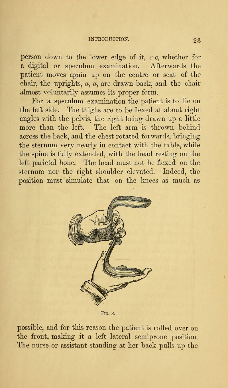 person down to the lower edge of it, c <?, whether for a digital or speculum examination. Afterwards the patient moves again up on the centre or seat of the chair, the uprights, a, a, are drawn back, and the chair almost voluntarily assumes its proper form. For a speculum examination the patient is to lie on the left side. The thighs are to be flexed at about right angles with the pelvis, the right being drawn up a little more than the left. The left arm is thrown behind across the back, and the chest rotated forwards, bringing the sternum very nearly in contact with the table, while the spine is fully extended, with the head resting on the left parietal bone. The head must not be flexed on the sternum nor the right shoulder elevated. Indeed, the position must simulate that on the knees as much as Fig. 8. possible, and for this reason the patient is rolled over on the front, making it a left lateral semiprone position. The nurse or assistant standing at her back pulls up the