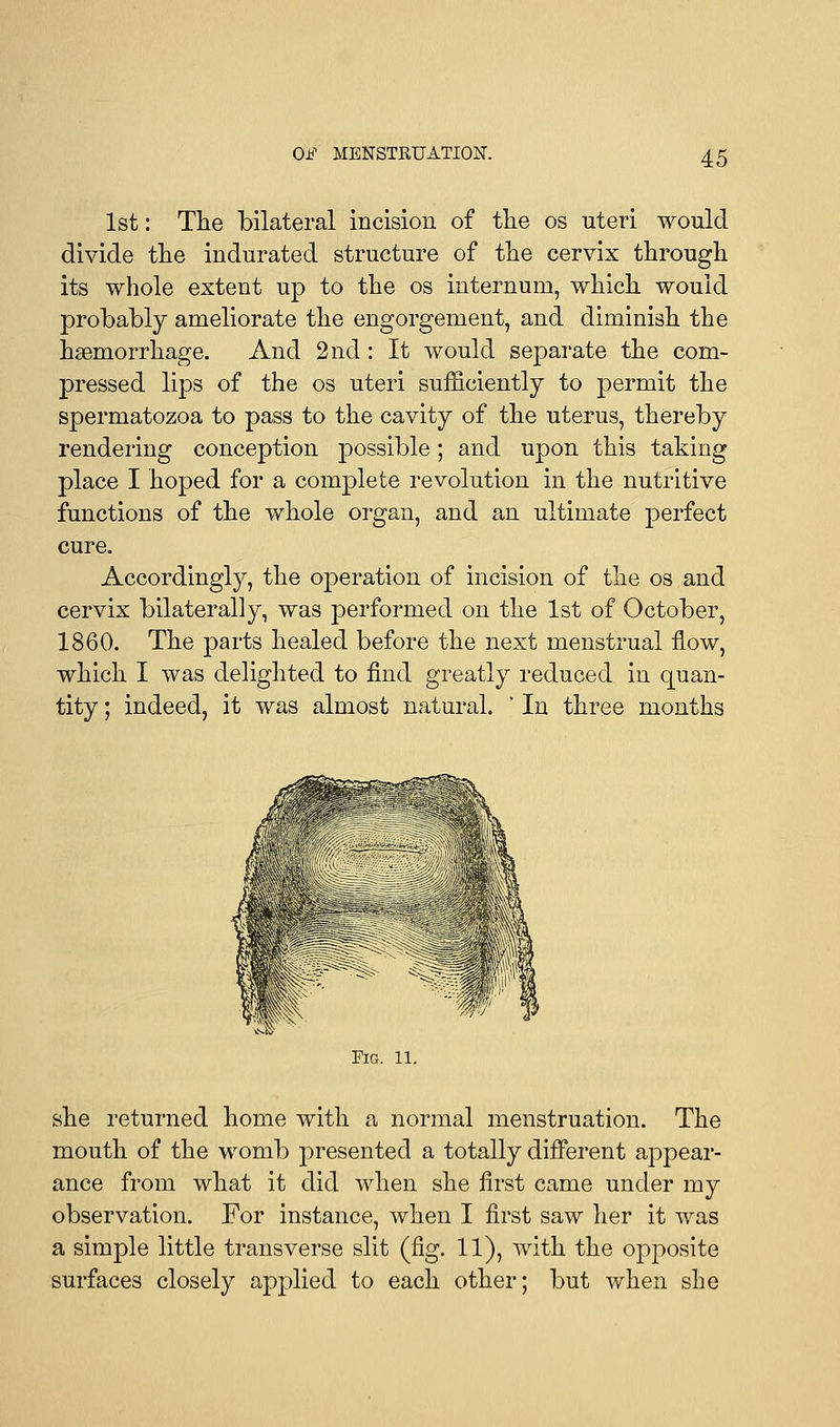 1st: The bilateral incision of the os uteri would divide the indurated structure of the cervix through its whole extent up to the os internum, which would probably ameliorate the engorgement, and diminish the haemorrhage. And 2nd: It would separate the com- pressed lips of the os uteri sufficiently to permit the spermatozoa to pass to the cavity of the uterus, thereby rendering conception possible; and upon this taking place I hoped for a complete revolution in the nutritive functions of the whole organ, and an ultimate perfect cure. Accordingly, the operation of incision of the os and cervix bilaterally, was performed on the 1st of October, 1860. The parts healed before the next menstrual flow, which I was delighted to find greatly reduced in quan- tity ; indeed, it was almost natural. ' In three months Fig. 11. she returned home with a normal menstruation. The mouth of the womb presented a totally different appear- ance from what it did when she first came under my observation. For instance, when I first saw her it was a simple little transverse slit (fig. 11), with the opposite surfaces closely applied to each other; but when she