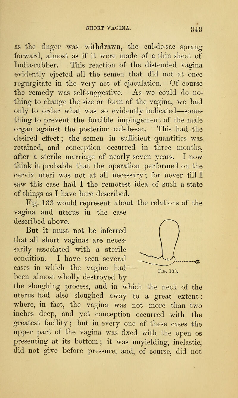 as the finger was withdrawn, the cul-de-sac sprang forward, almost as if it were made of a thin sheet of India-rubber. This reaction of the distended vagina evidently ejected all the semen that did not at once regurgitate in the very act of ejaculation. Of course the remedy was self-suggestive. As we could do no- thing to change the size or form of the vagina, we had only to order what was so evidently indicated—some- thing to prevent the forcible impingement of the male organ against the posterior cul-de-sac. This had the desired effect; the semen in sufficient quantities was retained, and conception occurred in three months, after a sterile marriage of nearly seven years. I now think it probable that the operation performed on the cervix uteri was not at all necessary; for never till I saw this case had I the remotest idea of such a state of things as I have here described. Fig. 133 would represent about the relations of the vagina and uterus in the case described above. But it must not be inferred that all short vaginas are neces- sarily associated with a sterile condition. I have seen several cases in which the vagina had F 133 been almost wholly destroyed by the sloughing process, and in which the neck of the uterus had also sloughed away to a great extent: where, in fact, the vagina was not more than two inches deep, and yet conception occurred with the greatest facility; but in every one of these cases the upper part of the vagina was fixed with the open os presenting at its bottom; it was unyielding, inelastic, did not give before pressure, and, of course, did not