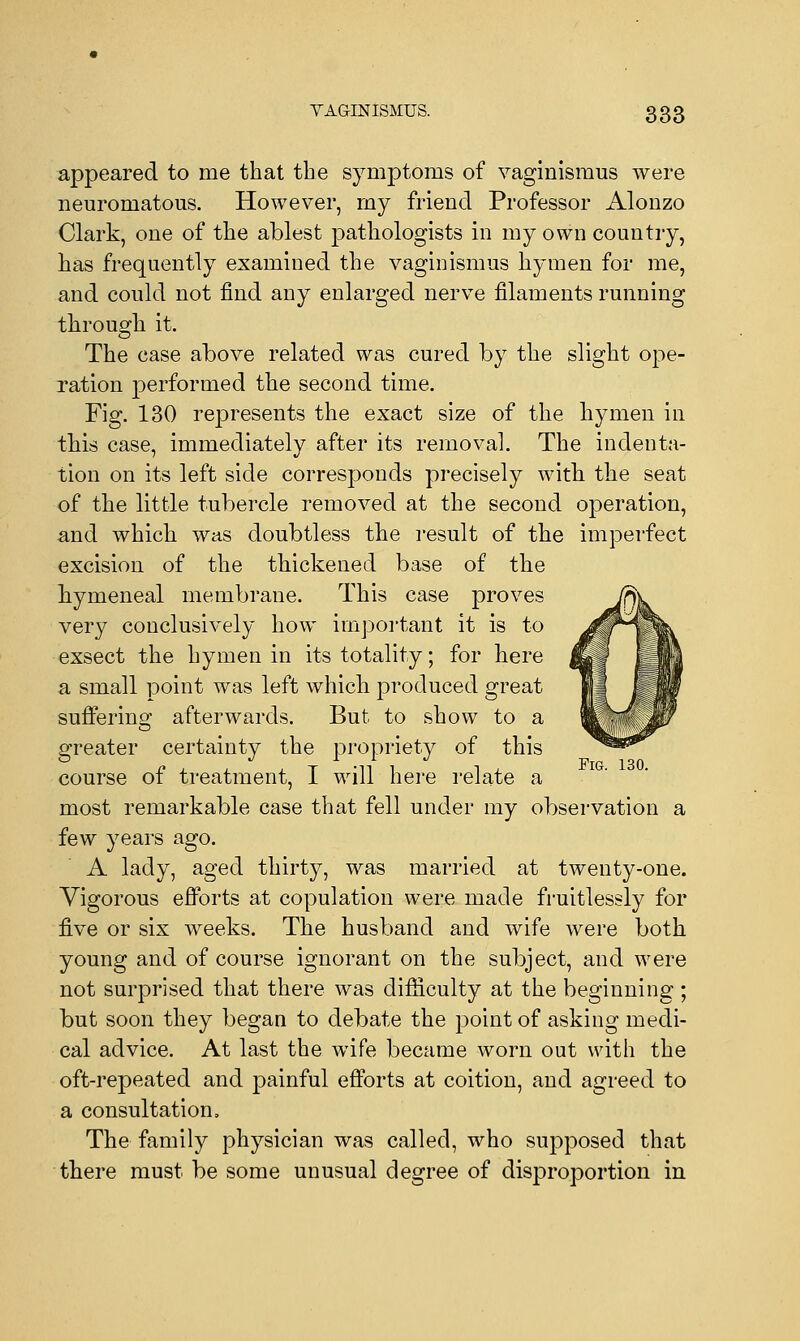 appeared to rne that the symptoms of vaginismus were neuromatous. However, my friend Professor Alonzo Clark, one of the ablest pathologists in my own country, has frequently examined the vaginismus hymen for me, and could not find any enlarged nerve filaments running through it. The case above related was cured by the slight ope- ration performed the second time. Fig. 130 represents the exact size of the hymen in this case, immediately after its removal. The indenta- tion on its left side corresponds precisely with the seat of the little tubercle removed at the second operation, and which was doubtless the result of the imperfect excision of the thickened base of the hymeneal membrane. This case proves very conclusively how important it is to exsect the hymen in its totality; for here a small point was left which produced great suffering afterwards. But to show to a greater certainty the propriety of this course of treatment, I will here relate a most remarkable case that fell under my observation a few years ago. A lady, aged thirty, was married at twenty-one. Vigorous efforts at copulation were made fruitlessly for five or six weeks. The husband and wife were both young and of course ignorant on the subject, and were not surprised that there was difficulty at the beginning ; but soon they began to debate the point of asking medi- cal advice. At last the wife became worn out with the oft-repeated and painful efforts at coition, and agreed to a consultation, The family physician was called, who supposed that there must be some unusual degree of disproportion in