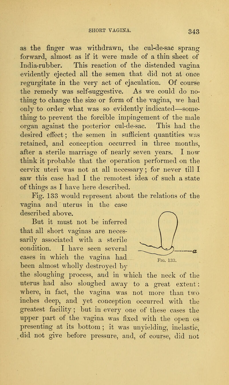 as the finger was withdrawn, the cul-de-sac sprang forward, almost as if it were made of a thin sheet of India-rubber. This reaction of the distended vagina evidently ejected all the semen that did not at once regurgitate in the very act of ejaculation. Of course the remedy was self-suggestive. As we could do no- thing to change the size or form of the vagina, we had only to order what was so evidently indicated—some- thing to prevent the forcible impingement of the male organ against the posterior cul-de-sac. This had the desired effect; the semen in sufficient quantities was retained, and conception occurred in three months, after a sterile marriage of nearly seven years. I now think it probable that the operation performed on the cervix uteri was not at all necessary; for never till I saw this case had I the remotest idea of such a state of things as I have here described. Fig. 133 would represent about the relations of the vagina and uterus in the case described above. But it must not be inferred that all short vaginas are neces- sarily associated with a sterile condition. I have seen several cases in which the vagina had been almost wholly destroyed by the sloughing process, and in which the neck of the uterus had also sloughed away to a great extent: where, in fact, the vagina was not more than two inches deep, and yet conception occurred with the greatest facility; but in every one of these cases the upper part of the vagina was fixed with the open os presenting at its bottom ; it was unyielding, inelastic, did not give before pressure, and, of course, did not