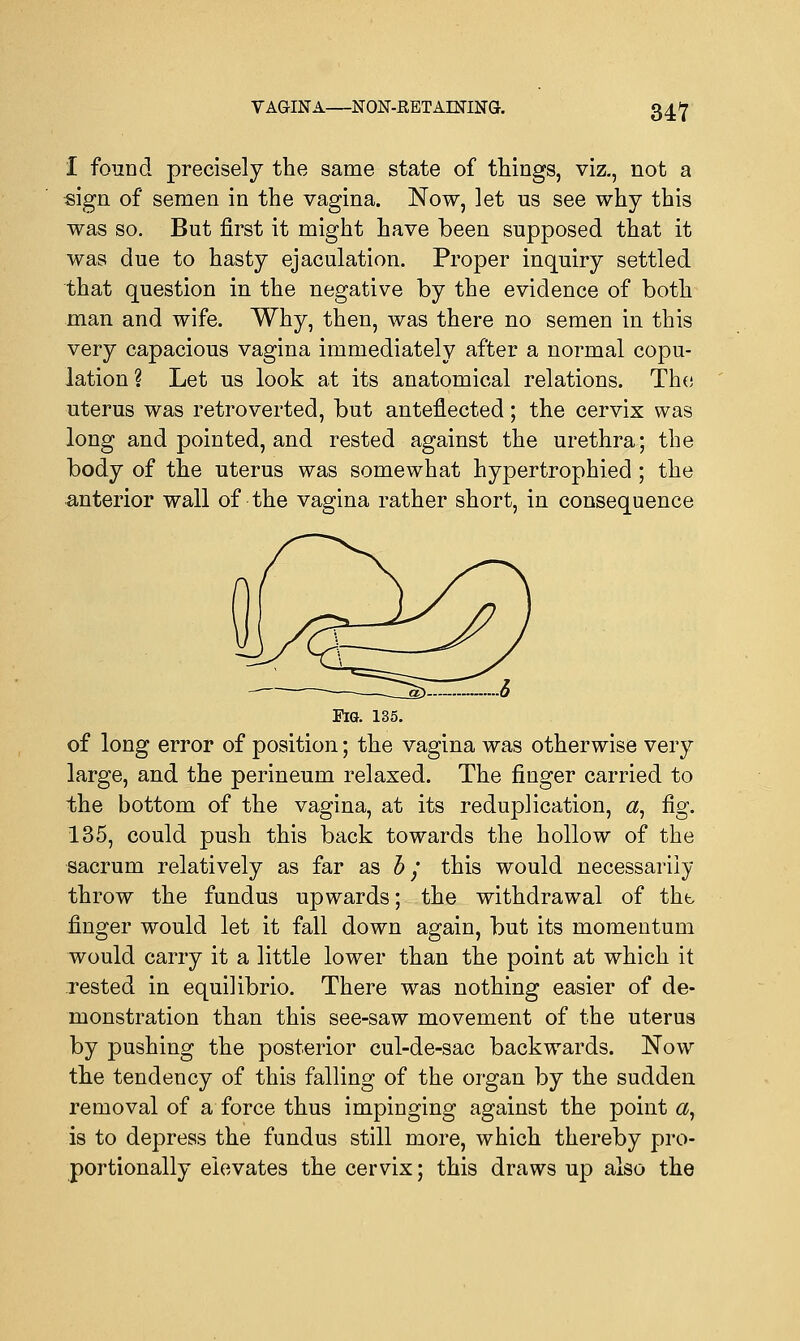 1 found precisely the same state of things, viz., not a sign of semen in the vagina. Now, ]et us see why this was so. But first it might have been supposed that it was due to hasty ejaculation. Proper inquiry settled that question in the negative by the evidence of both man and wife. Why, then, was there no semen in this very capacious vagina immediately after a normal copu- lation? Let us look at its anatomical relations. The uterus was retro verted, but anteflected; the cervix was long and pointed, and rested against the urethra; the body of the uterus was somewhat hypertrophied ; the anterior wall of the vagina rather short, in consequence .6 Fig. 135. of long error of position; the vagina was otherwise very large, and the perineum relaxed. The finger carried to the bottom of the vagina, at its reduplication, «, fig. 135, could push this back towards the hollow of the sacrum relatively as far as b; this would necessarily throw the fundus upwards; the withdrawal of the finger would let it fall down again, but its momentum would carry it a little lower than the point at which it rested in equilibrio. There was nothing easier of de- monstration than this see-saw movement of the uterus by pushing the posterior cul-de-sac backwards. Now the tendency of this falling of the organ by the sudden removal of a force thus impinging against the point «, is to depress the fundus still more, which thereby pro- portionally elevates the cervix; this draws up also the