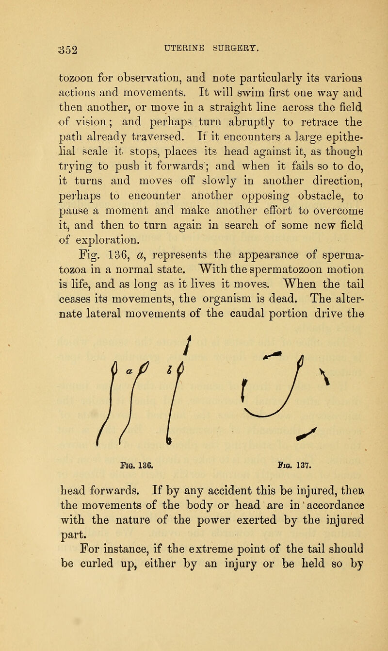 tozoon for observation, and note particularly its various actions and movements. It will swim first one way and then another, or move in a straight line across the field of vision ; and perhaps turn abruptly to retrace the path already traversed. It it encounters a large epithe- lial scale it stops, places its head against it, as though trying to push it forwards'; and when it fails so to do, it turns and moves off slowly in another direction, perhaps to encounter another opposing obstacle, to jDause a moment and make another effort to overcome it, and then to turn again in search of some new field of exploration. Fig. 136, <2, represents the appearance of sperma- tozoa in a normal state. With the spermatozoon motion is life, and as long as it lives it moves. When the tail ceases its movements, the organism is dead. The alter- nate lateral movements of the caudal portion drive the \ S ElG. 136. Pig. 137. head forwards. If by any accident this be injured, thea the movements of the body or head are in' accordance with the nature of the power exerted by the injured part. For instance, if the extreme point of the tail should be curled up, either by an injury or be held so by