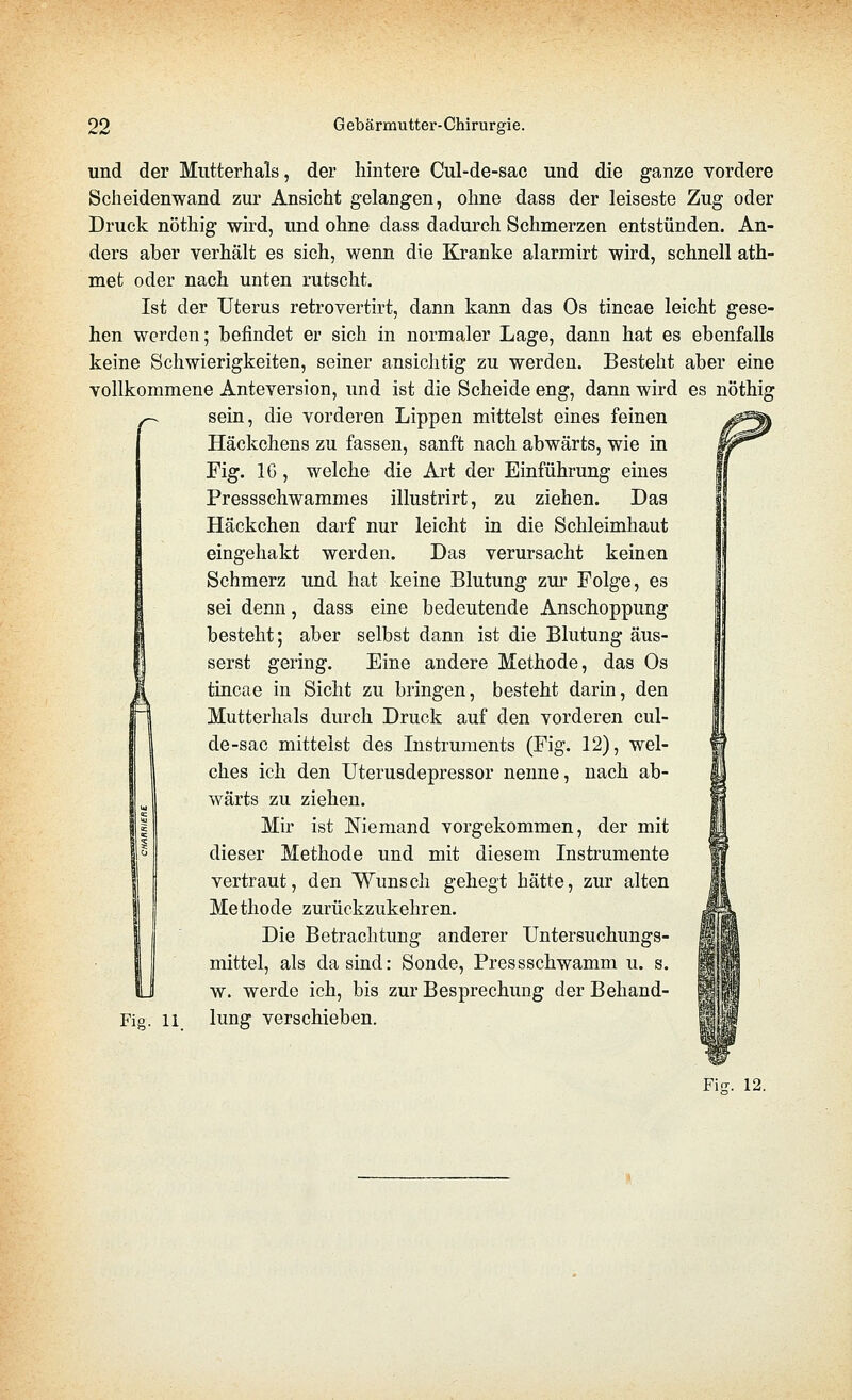 und der Miitterhals, der hintere Cul-de-sac und die ganze vordere Scheidenwand zur Ansicht gelangen, ohne dass der leiseste Zug oder Druck nöthig wird, und ohne dass dadurch Schmerzen entstünden. An- ders aber verhält es sich, wenn die Kranke alarmirt wird, schnell ath- met oder nach unten rutscht. Ist der Uterus retrovertirt, dann kann das Os tincae leicht gese- hen werden; befindet er sich in normaler Lage, dann hat es ebenfalls keine Schwierigkeiten, seiner ansichtig zu werden. Besteht aber eine vollkommene Anteversion, und ist die Scheide eng, dann wird es nöthig ^ sein, die vorderen Lippen mittelst eines feinen Häckchens zu fassen, sanft nach abwärts, wie in Fig. IG , welche die Art der Einführung eines Pressschwammes illustrirt, zu ziehen. Das Häckchen darf nur leicht in die Schleimhaut eingehakt werden. Das verursacht keinen Schmerz und hat keine Blutung zur Folge, es sei denn, dass eine bedeutende Anschoppung besteht; aber selbst dann ist die Blutung äus- serst gering. Eine andere Methode, das Os tincae in Sicht zu bringen, besteht darin, den Mutterhals durch Druck auf den vorderen cul- de-sac mitteist des Instruments (Fig. 12), wel- ches ich den Uterusdepressor nenne, nach ab- wärts zu ziehen. Mir ist Niemand vorgekommen, der mit dieser Methode und mit diesem Instrumente vertraut, den Wunsch gehegt hätte, zur alten Methode zurückzukehren. Die Betrachtung anderer Untersuchungs- mittel, als dasind: Sonde, Pressschwamm u. s. w. werde ich, bis zur Besprechung der Behand- Fig. 11 lung verschieben.