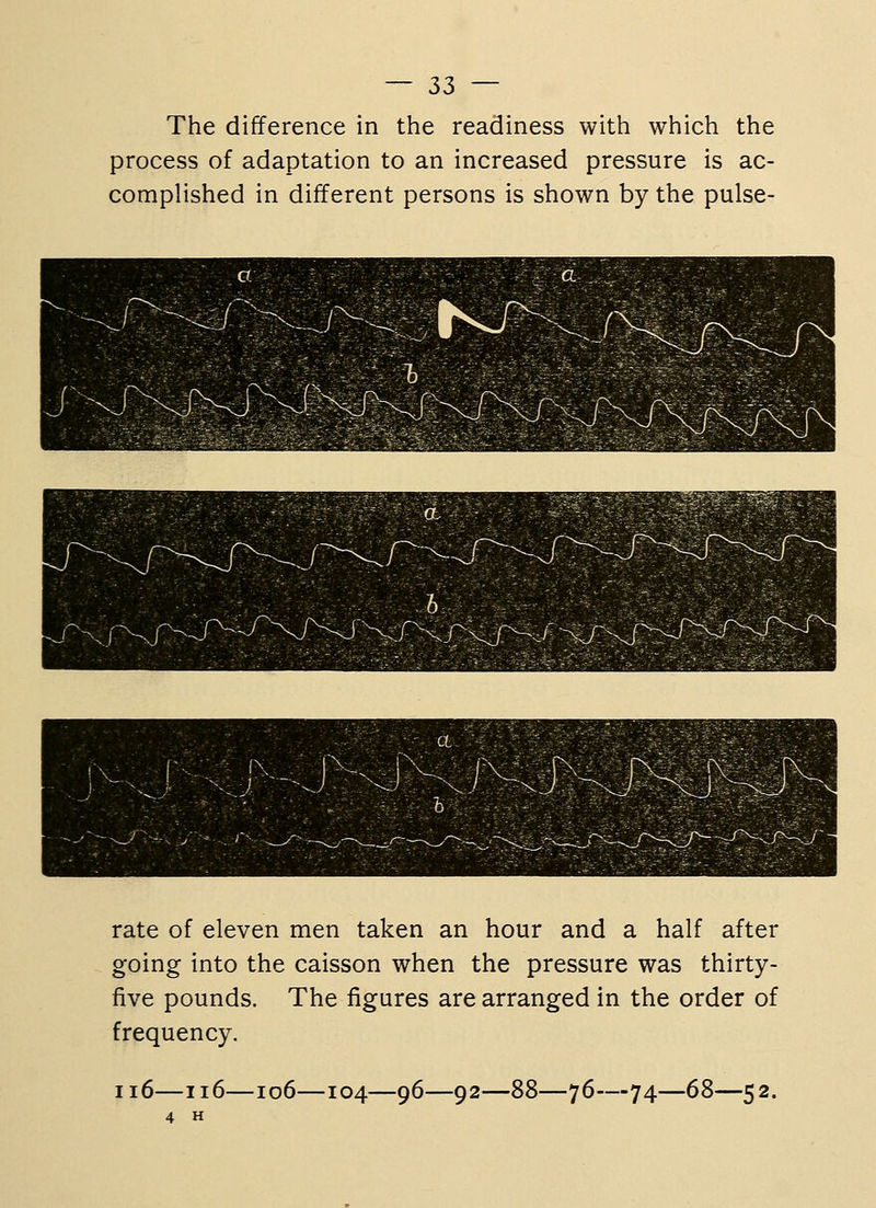 The difference in the readiness with which the process of adaptation to an increased pressure is ac- complished in different persons is shown by the pulse- rate of eleven men taken an hour and a half after going into the caisson when the pressure was thirty- five pounds. The figures are arranged in the order of frequency. ii6—ii6- 4 H io6—104—96—92- ■76—74—68—52.