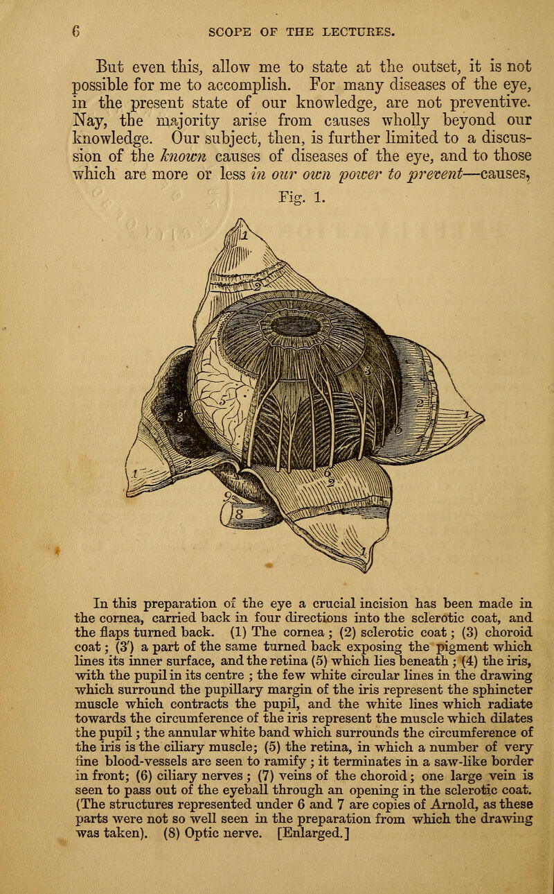 But even this, allow me to state at the outset, it is not possible for me to accomplish. For many diseases of the eye, in the present state of our knowledge, are not preventive. Nay, the majority arise from causes wholly beyond our knowledge. Our subject, then, is further limited to a discus- sion of the known causes of diseases of the eye, and to those which are more or less in our own 'power to prevent—causes, Fig. 1. In this preparation of the eye a crucial incision has been made in the cornea, carried back in four directions into the sclerotic coat, and the flaps turned back. (1) The cornea ; (2) sclerotic coat; (3) choroid coat; (3') a part of the same turned back exposing the pigment which lines its inner surface, and the retina (5) which lies beneath ; (4) the iris, with the pupil in its centre ; the few white circular lines in the drawing which surround the pupillary margin of the iris represent the sphincter muscle which contracts the pupil, and the white lines which radiate towards the circumference of the iris represent the muscle which dilates the pupil; the annular white band which surrounds the circumference of the iris is the ciliary muscle; (5) the retina, in which a number of very line blood-vessels are seen to ramify ; it terminates in a saw-like border in front; (6) ciliary nerves ; (7) veins of the choroid; one large vein is seen to pass out of the eyeball through an opening in the sclerotic coat. (The structures represented under 6 and 7 are copies of Arnold, as these parts were not so well seen in the preparation from which the drawing was taken). (8) Optic nerve. [Enlarged.]