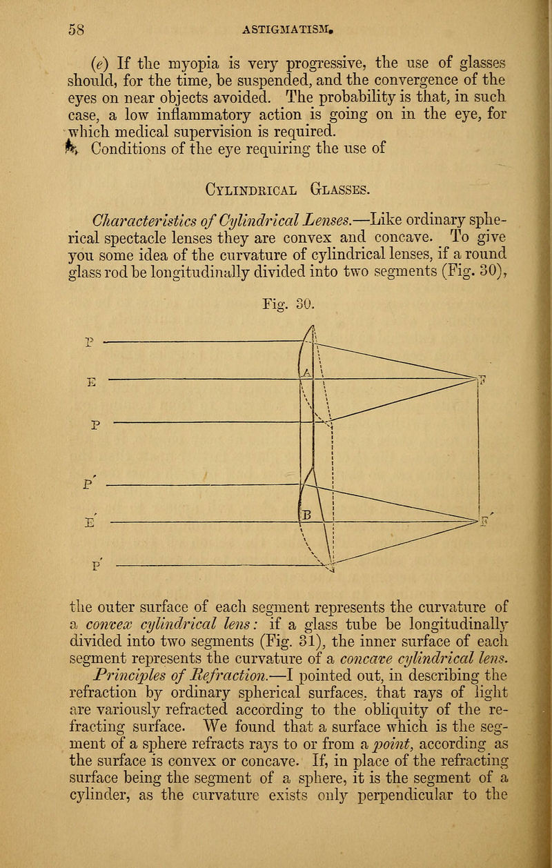 (e) If tlie myopia is very progressive, the use of glasses should, for the time, be suspended, and the convergence of the eyes on near objects avoided. The probability is that, in such case, a low inflammatory action is going on in the eye, for which medical supervision is required. ht Conditions of the eye requiring the use of Cylindrical Glasses. Characteristics of Cylindrical Lenses.—Like ordinary sphe- rical spectacle lenses they are convex and concave. To give you some idea of the curvature of cylindrical lenses, if a round glass rod be longitudinally divided into two segments (Fig. 30), the outer surface of each segment represents the curvature of a convex cylindrical lens: if a glass tube be longitudinally divided into two segments (Fig. 31), the inner surface of each segment represents the curvature of a concave cylindrical lens. Principles of Refraction.—I pointed out, in describing the refraction by ordinary spherical surfaces, that rays of light are variously refracted according to the obliquity of the re- fracting surface. We found that a surface which is the seg- ment of a sphere refracts rays to or from a point, according as the surface is convex or concave. If, in place of the refracting surface being the segment of a sphere, it is the segment of a cylinder, as the curvature exists only perpendicular to the