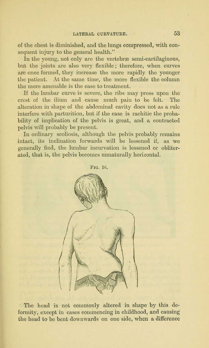 of the chest is diminished, and the lungs compressed, with con- sequent injury to the general health. In the young, not only are the vertebras semi-cartilaginous, but the joints are also very flexible; therefore, when curves are once formed, they increase the more rapidly the younger the patient. At the same time, the more flexible the column the more amenable is the case to treatment. If the lumbar curve is severe, the ribs may press upon the crest of the ilium and cause much pain to be felt. The alteration in shape of the abdominal cavity does not as a rule interfere with parturition, but if the case is rachitic the proba- bility of implication of the pelvis is great, and a contracted pelvis will probably be present. In ordinary scoliosis, although the pelvis probably remains intact, its inclination forwards will be lessened if, as we generally find, the lumbar incurvation is lessened or obliter- ated, that is, the pelvis becomes unnaturally horizontal. Fig. 16. The head is not commonly altered in shape by this de- formity, except in cases commencing in childhood, and causing the head to be bent downwards on one side, when a difference