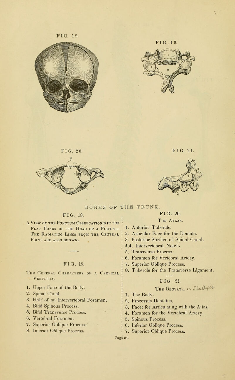 FIG. 19. FIG. 20. FIG. 21. BONES OF T FIG. 18. A View or the Functum Ossificationis in 'rnE ; Flat Bones of the Head of a Fcetus— , The Radiating Lines from the Central, j Point are also shown. J FIG. 19. The General CuARAciKUd of a Cervical Vertebra. 1. Upper Face of the Body. 2. Spinal Canal. 3. Half of an Intervertebral Foramen. 4. Bifid Spinous Pi'ocess. ! 5. Bifid Transverse Process. ' i 6. Vertebral Foramen. 7. Superior Oblique Process. 8. Inferior Oblique Process. j HE TRUNK. FIG. 20. The Ailao. 1. Anterior Tubercle. 2. Articular Face for the Dentata. 3. Posterior Surface of Spinal Canal, 4.4. Intervertebral Notch. 5. Transverse Process. 6. Foramen for Vertebral Artery. 7. Superior Oblique Process. 8. Tubercle for the Transverse Ligament. FIG. -21. The Den'iat... r^ jl^CKi^^' 1. The Body. 2. Processus Dentatus. 3. Facet for Articulating with the Atlas. 4. Foramen for the Vertebral Artery. 5. Spinous Process. 6. Inferior Oblique Process. 7. Superior Oblique Process.