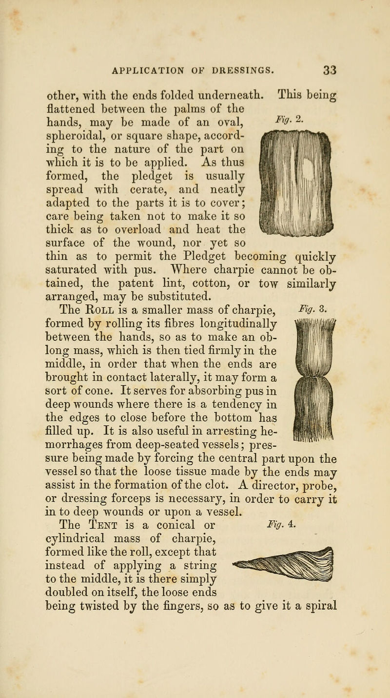 Fig. 2. Fig. 3. other, with the ends folded underneath. This being flattened between the palms of the hands, may be made of an oval, spheroidal, or square shape, accord- ing to the nature of the part on which it is to be applied. As thus formed, the pledget is usually spread with cerate, and neatly adapted to the parts it is to cover; care being taken not to make it so thick as to overload and heat the surface of the wound, nor yet so thin as to permit the Pledget becoming quickly saturated with pus. Where charpie cannot be ob- tained, the patent lint, cotton, or tow similarly arranged, may be substituted. The Roll is a smaller mass of charpie, formed by rolling its fibres longitudinally between the hands, so as to make an ob- long mass, which is then tied firmly in the middle, in order that when the ends are brought in contact laterally, it may form a sort of cone. It serves for absorbing pus in deep wounds where there is a tendency in the edges to close before the bottom has filled up. It is also useful in arresting he- morrhages from deep-seated vessels; pres- sure being made by forcing the central part upon the vessel so that the loose tissue made by the ends may assist in the formation of the clot. A director, probe, or dressing forceps is necessary, in order to carry it in to deep w^ounds or upon a vessel. The Tent is a conical or cylindrical mass of charpie, formed like the roll, except that instead of applying a string to the middle, it is there simply doubled on itself, the loose ends being twisted by the fingers, so as to give it a spiral Fig. 4.