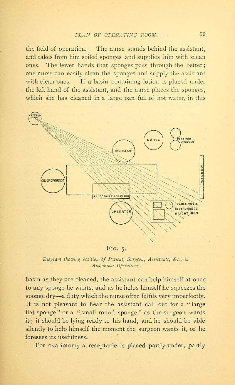 the field of operation. The nurse stands behind the assistant, and takes from him soiled sponges and supplies him with clean ones. The fewer hands that sponges pass through the better; one nurse can easity clean the sponges and supply the assistant with clean ones. If a basin containing lotion is placed under the left hand of the assistant, and the nurse places the sponges, which she has cleaned in a large pan full of hot water, in this PANS Foa z' NSFOBICES \ ^^,^\^^s\^^-^X^\^'C^^- HECEPTADLEFDRFLUip n^'\x^ '^^ ^ TABLE-WITH-, iraSTRUMEMTS a LIGATURES Fig. 5. Diagram showing position of Patient, Surgeon, Assistants, &c., in Abdominal Operations. basin as they are cleaned, the assistant can help himself at once to any sponge he wants, and as he helps himself he squeezes the sponge dry—a duty which the nurse often fulfils very imperfectly. It is not pleasant to hear the assistant call out for a  large flat sponge or a small round sponge as the surgeon wants it; it should be lying ready to his hand, and he should be able silently to help himself the moment the surgeon wants it, or he foresees its usefulness. For ovariotomy a receptacle is placed partly under, partly