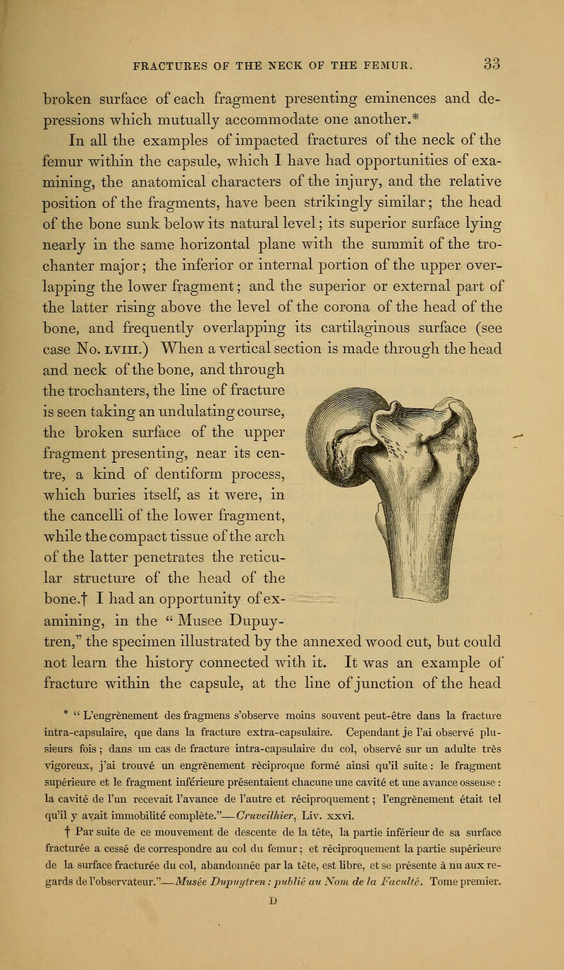 broken surface of eacli fragment presenting eminences and de- pressions wliicli mutually accommodate one anotlier.* In all tlie examples of impacted fractures of tlie neck of tlie femur witliin the capsule, which I have had opportunities of exa- mining, the anatomical characters of the injury, and the relative position of the fragments, have been strikingly similar; the head of the bone sunk below its natural level; its superior surface lying nearly in the same horizontal plane with the summit of the tro- chanter major; the inferior or internal portion of the upper over- lapping the lower fragment; and the superior or external part of the latter rising above the level of the corona of the head of the bone, and frequently overlapping its cartilaginous surface (see case No. lviii.) Wlien a vertical section is made through the head and neck of the bone, and through the trochanters, the line of fracture is seen taking an undulating course, the broken surface of the upper fragment presenting, near its cen- tre, a kind of dentiform process, which buries itself, as it were, in the cancelli of the lower fragment, while the compact tissue of the arch of the latter penetrates the reticu- lar structure of the head of the bone.f I had an opportunity of ex- amining, in the  Musee Dupuy- tren, the specimen illustrated by the annexed wood cut, but could not learn the history connected with it. It was an example of fracture within the capsule, at the line of junction of the head *  L'engrenement des fragmens s'observe moins souvent peut-etre dans la fractiu-e intra-capstdaii-e, que dans la fracture extra-capsulaire. Cependant je I'ai observe plu- sieurs fois ; dans iin cas de fracture intra-capsulaire du col, observe sur un adulte tres vigoreux, j'ai trouve un engrfinement r^ciproque forme ainsi qu'il suite: le fragment superieure et le fragment inferieure presentaient chacmie une cavite et une avance osseuse : la cavite de I'un recevait I'avance de I'autre et reciproquement; l'engrenement etait lei qu'il y ayait immobilite complete.— CruveiUiier, Liv. xxvi. f Par suite de ce mouvement de descente de la tete, la partie inferieur de sa surface fi'actm'ee a cesse de correspondre au col du femur; et reciproquement la partie superiem-e de la sm-face fracturee du col, abandonnee par la tete, est libre, et se presente a nu aux re- gards de I'observateur.—Musee Dupvytren: puhlie au Nom de la Faculte. Tome premier. B