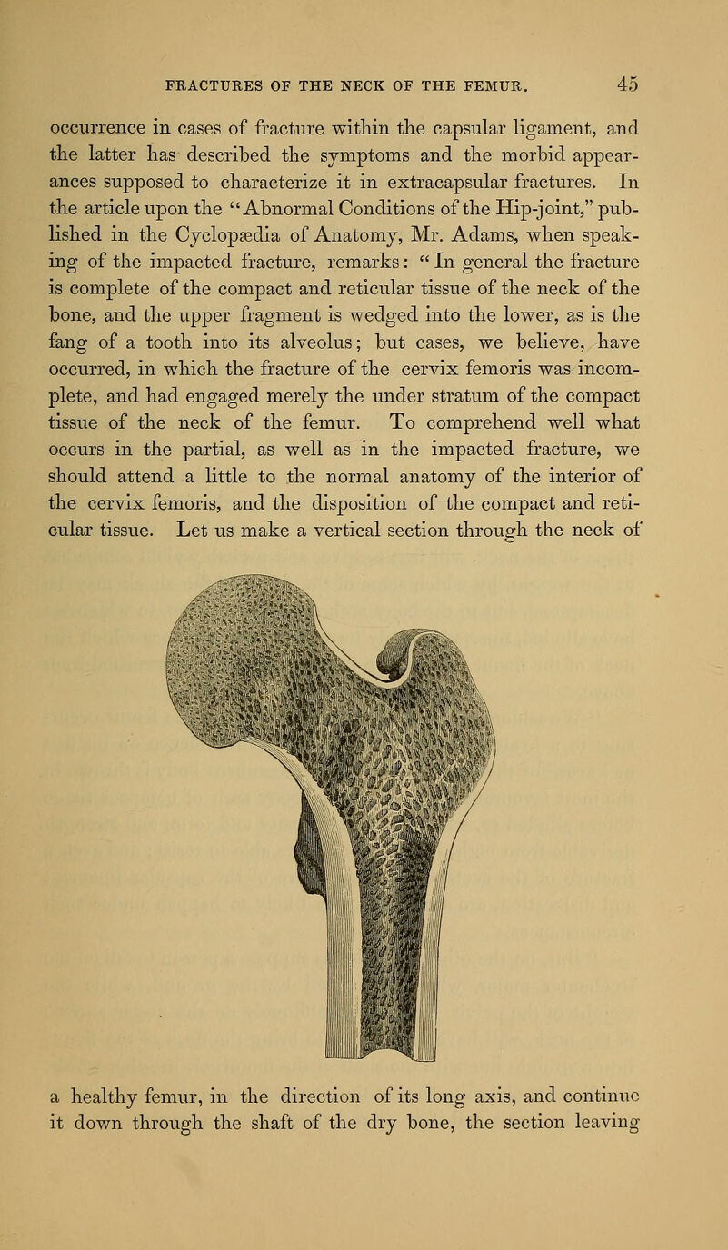 occurrence in cases of fractiire within tlie capsular ligament, and the latter lias described the symptoms and the morbid appear- ances supposed to characterize it in extracapsular fractures. In the article upon the Abnormal Conditions of the Hip-joint, pub- lished in the Cyclopgedia of Anatomy, Mr. Adams, when speak- ing of the impacted fracture, remarks:  In general the fracture is complete of the compact and reticular tissue of the neck of the bone, and the upper fragment is wedged into the lower, as is the fang of a tooth into its alveolus; but cases, we believe, have occurred, in which the fracture of the cervix femoris was incom- plete, and had engaged merely the under stratum of the compact tissue of the neck of the femur. To comprehend well what occurs in the partial, as well as in the impacted fracture, we should attend a little to the normal anatomy of the interior of the cervix femoris, and the disposition of the compact and reti- cular tissue. Let us make a vertical section through the neck of a healthy fenuu% in the direction of its long axis, and continue it down through the shaft of the dry bone, the section leaving