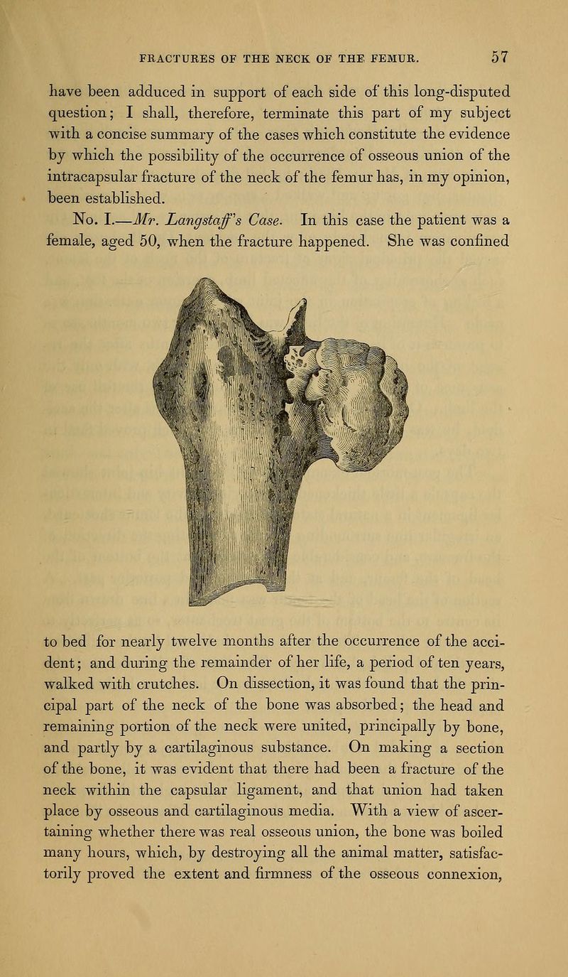 have been adduced in support of each side of this long-disputed question; I shall, therefore, terminate this part of my subject with a concise summary of the cases which constitute the evidence by which the possibility of the occurrence of osseous union of the intracapsular fracture of the neck of the femur has, in my opinion, been established. No. I.—Mr. Langstaff's Case- In this case the patient was a female, aged 50, when the fracture happened. She was confined to bed for nearly twelve months after the occurrence of the acci- dent ; and during the remainder of her life, a period of ten years, walked with crutches. On dissection, it was found that the prin- cipal part of the neck of the bone was absorbed; the head and remaining portion of the neck were united, principally by bone, and partly by a cartilaginous substance. On making a section of the bone, it was evident that there had been a fracture of the neck within the capsular ligament, and that union had taken place by osseous and cartilaginous media. With a view of ascer- taining whether there was real osseous union, the bone was boiled many hours, which, by destroying all the animal matter, satisfac- torily proved the extent and firmness of the osseous connexion,