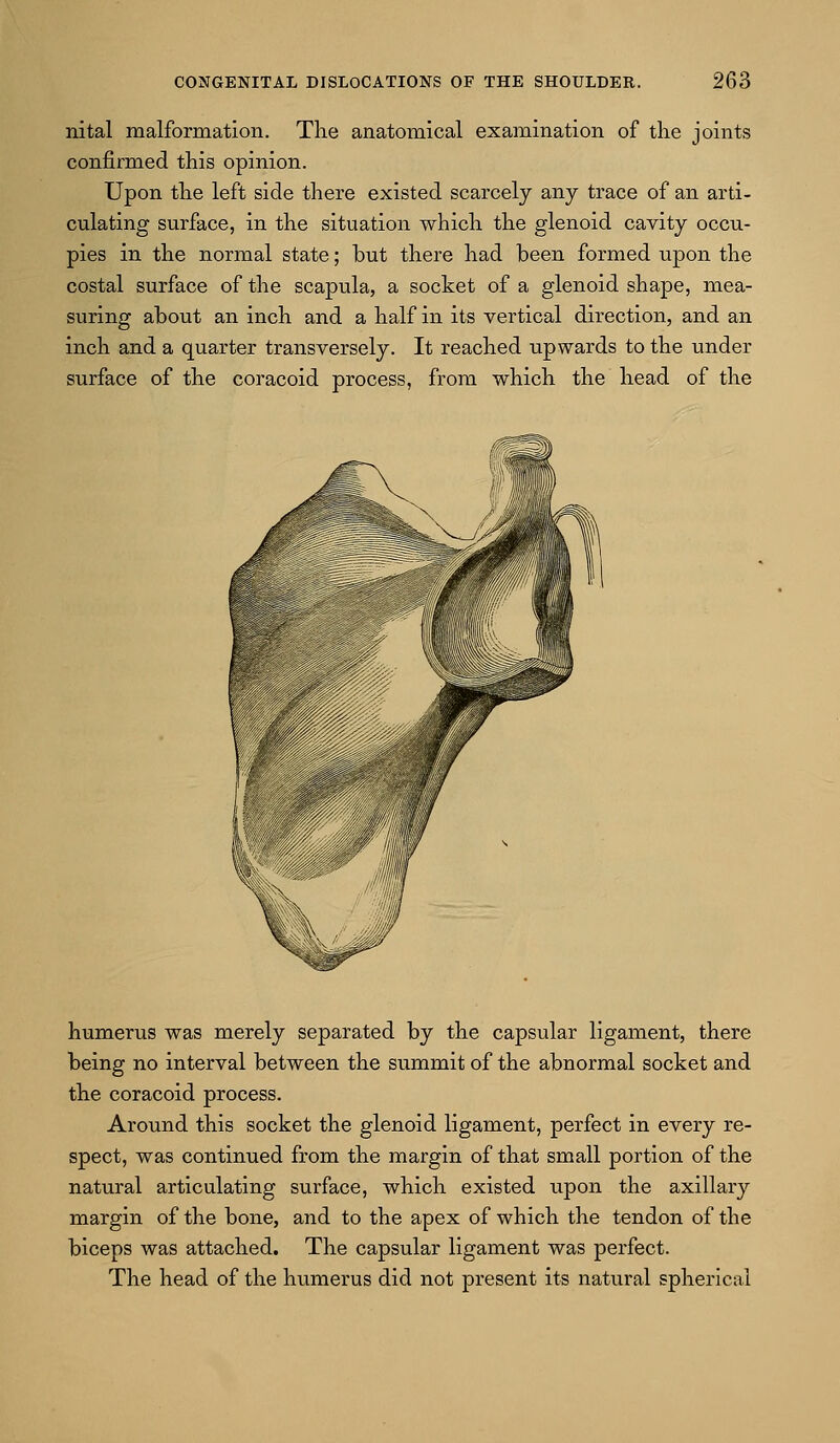 nital malformation. The anatomical examination of the joints confirmed this opinion. Upon the left side there existed scarcely any trace of an arti- culating surface, in the situation which the glenoid cavity occu- pies in the normal state; but there had been formed upon the costal surface of the scapula, a socket of a glenoid shape, mea- suring about an inch and a half in its vertical direction, and an inch and a quarter transversely. It reached upwards to the under surface of the coracoid process, from which the head of the humerus was merely separated by the capsular ligament, there being no interval between the summit of the abnormal socket and the coracoid process. Around this socket the glenoid ligament, perfect in every re- spect, was continued from the margin of that small portion of the natural articulating surface, which existed upon the axillary margin of the bone, and to the apex of which the tendon of the biceps was attached. The capsular ligament was perfect. The head of the humerus did not present its natural spherical