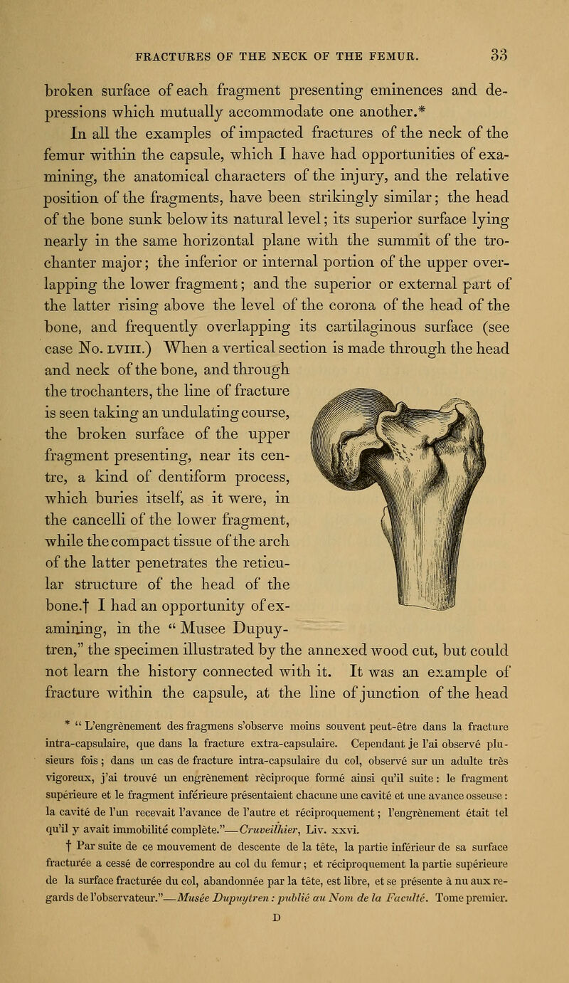 broken surface of each fragment presenting eminences and de- pressions which mutually accommodate one another.* In all the examples of impacted fractures of the neck of the femur within the capsule, which I have had opportunities of exa- mining, the anatomical characters of the injury? and the relative position of the fragments, have been strikingly similar; the head of the bone sunk below its natural level; its superior surface lying nearly in the same horizontal plane with the summit of the tro- chanter major; the inferior or internal portion of the upper over- lapping the lower fragment; and the superior or external part of the latter rising above the level of the corona of the head of the bone, and frequently overlapping its cartilaginous surface (see case No. lviii.) When a vertical section is made through the head and neck of the bone, and through the trochanters, the line of fracture is seen taking an ^undulating course, the broken surface of the upper fragment presenting, near its cen- tre, a kind of dentiform process, which buries itself, as it were, in the cancelli of the lower fragment, while the compact tissue of the arch of the latter penetrates the reticu- lar structure of the head of the bone.f I had an opportunity of ex- amining, in the  Musee Dupuy- tren, the specimen illustrated by the annexed wood cut, but could not learn the history connected with it. It was an example of fracture within the capsule, at the line of junction of the head *  L'engrenement des fragmens s'observe moins souvent peut-etre dans la fracture intra-capsulaire, que dans la fracture extra-capsulaire. Cependant je l'ai observe plu- sieurs fois; dans un cas de fracture intra-capsulaire du col, observe sur un adulte tres vigoreux, j'ai trouve un engrenement reciproque forme ainsi qu'il suite: le fragment superieure et le fragment inferieure presentaient chacune une cavite et une avance osseuse: la cavite de l'un recevait l'avance de l'autre et reciproquement; l'engrenement etait tel qu'il y avait immobility complete.-— Cruveilhier, Liv. xxvi. f Par suite de ce mouvement de descente de la tete, la partie inferieur de sa surface fracturee a cesse de correspondre au col du femur; et reciproquement la partie superieure de la surface fracturee du col, abandonnee par la tete, est libre, et se presente a nu anx re- gards de l'obscrvateiu'.—Musee Dupnytren: public an Nom de la Faeulte. Tome premier. D