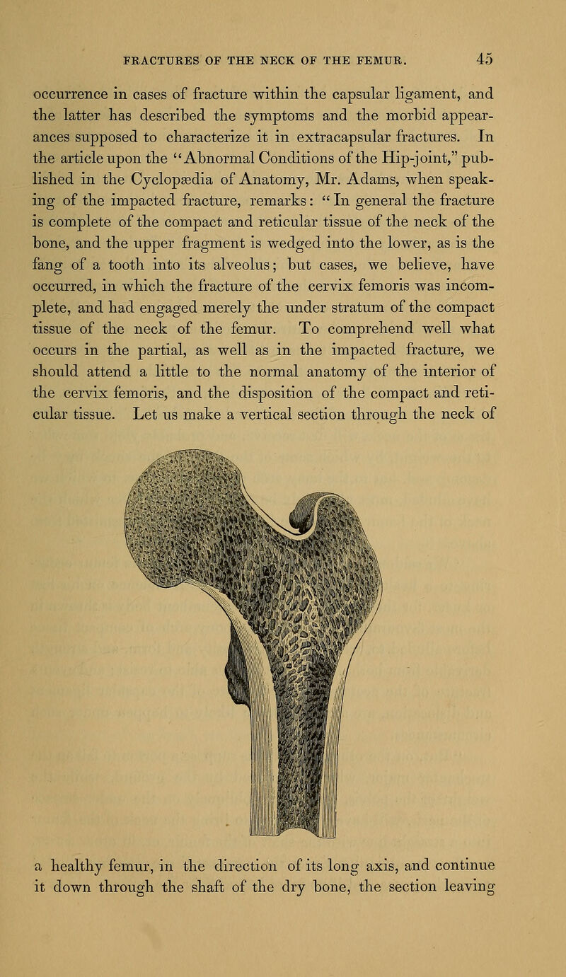 occurrence in cases of fracture within the capsular ligament, and the latter has described the symptoms and the morbid appear- ances supposed to characterize it in extracapsular fractures. In the article upon the Abnormal Conditions of the Hip-joint, pub- lished in the Cyclopaedia of Anatomy, Mr. Adams, when speak- ing of the impacted fracture, remarks:  In general the fracture is complete of the compact and reticular tissue of the neck of the bone, and the upper fragment is wedged into the lower, as is the fang of a tooth into its alveolus; but cases, we believe, have occurred, in which the fracture of the cervix femoris was incom- plete, and had engaged merely the under stratum of the compact tissue of the neck of the femur. To comprehend well what occurs in the partial, as well as in the impacted fracture, we should attend a little to the normal anatomy of the interior of the cervix femoris, and the disposition of the compact and reti- cular tissue. Let us make a vertical section through the neck of ipiiiiiiii a healthy femur, in the direction of its long axis, and continue it down through the shaft of the dry bone, the section leaving