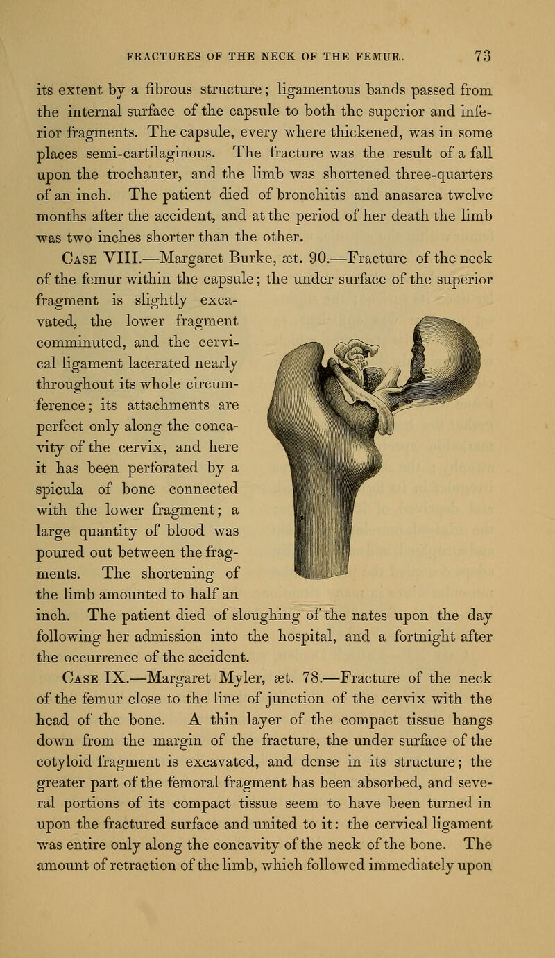 its extent by a fibrous structure; ligamentous bands passed from trie internal surface of the capsule to both trie superior and infe- rior fragments. The capsule, every where thickened, was in some places semi-cartilaginous. The fracture was the result of a fall upon the trochanter, and the limb was shortened three-quarters of an inch. The patient died of bronchitis and anasarca twelve months after the accident, and at the period of her death the limb was two inches shorter than the other. Case VIII.—Margaret Burke, ast. 90.—Fracture of the neck of the femur within the capsule; the under surface of the superior fragment is slightly exca- vated, the lower fragment comminuted, and the cervi- cal ligament lacerated nearly throughout its whole circum- ference; its attachments are perfect only along the conca- vity of the cervix, and here it has been perforated by a spicula of bone connected with the lower fragment; a large quantity of blood was poured out between the frag- ments. The shortening of the limb amounted to half an inch. The patient died of sloughing of the nates upon the day following her admission into the hospital, and a fortnight after the occurrence of the accident. Case IX.—Margaret Myler, get. 78.—Fracture of the neck of the femur close to the line of junction of the cervix with the head of the bone. A thin layer of the compact tissue hangs down from the margin of the fracture, the under surface of the cotyloid fragment is excavated, and dense in its structure; the greater part of the femoral fragment has been absorbed, and seve- ral portions of its compact tissue seem to have been turned in upon the fractured surface and united to it: the cervical ligament was entire only along the concavity of the neck of the bone. The amount of retraction of the limb, which followed immediately upon k;^